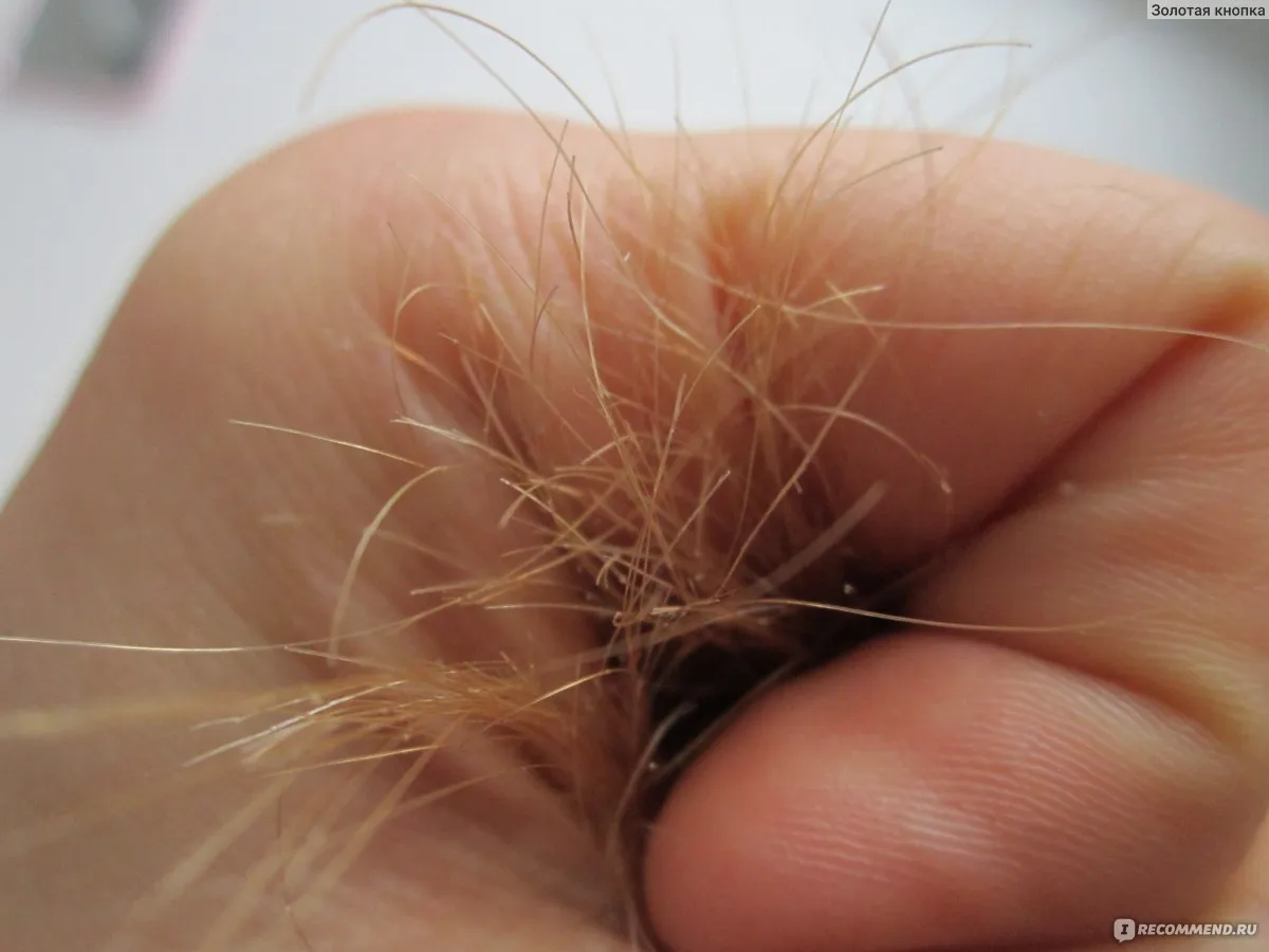 | Салон красоты | allergiya na shampun