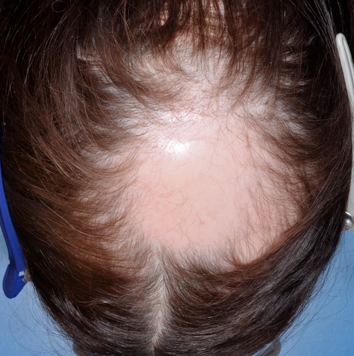 | Салон красоты | alopetsiya 1