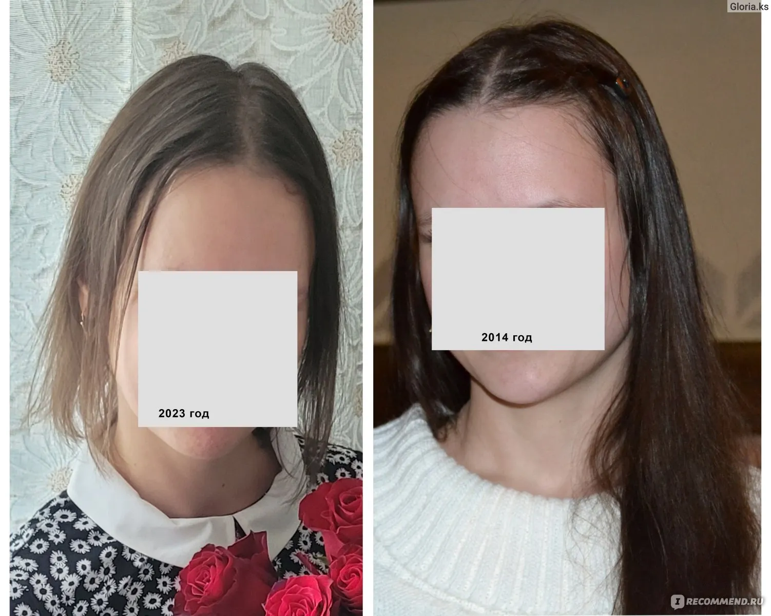 Практическое руководство - Проблемы с волосами: причины, решения и профилактика | Объективные советы Визуальное руководство по: анализы на выпадение волос