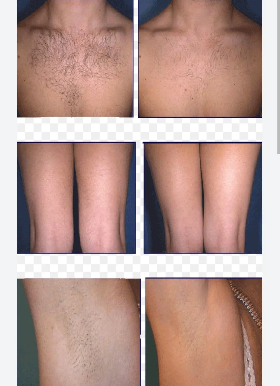 Что вредно для волос: сравнение здоровых и поврежденных волос под микроскопом, влияние тепла и химии