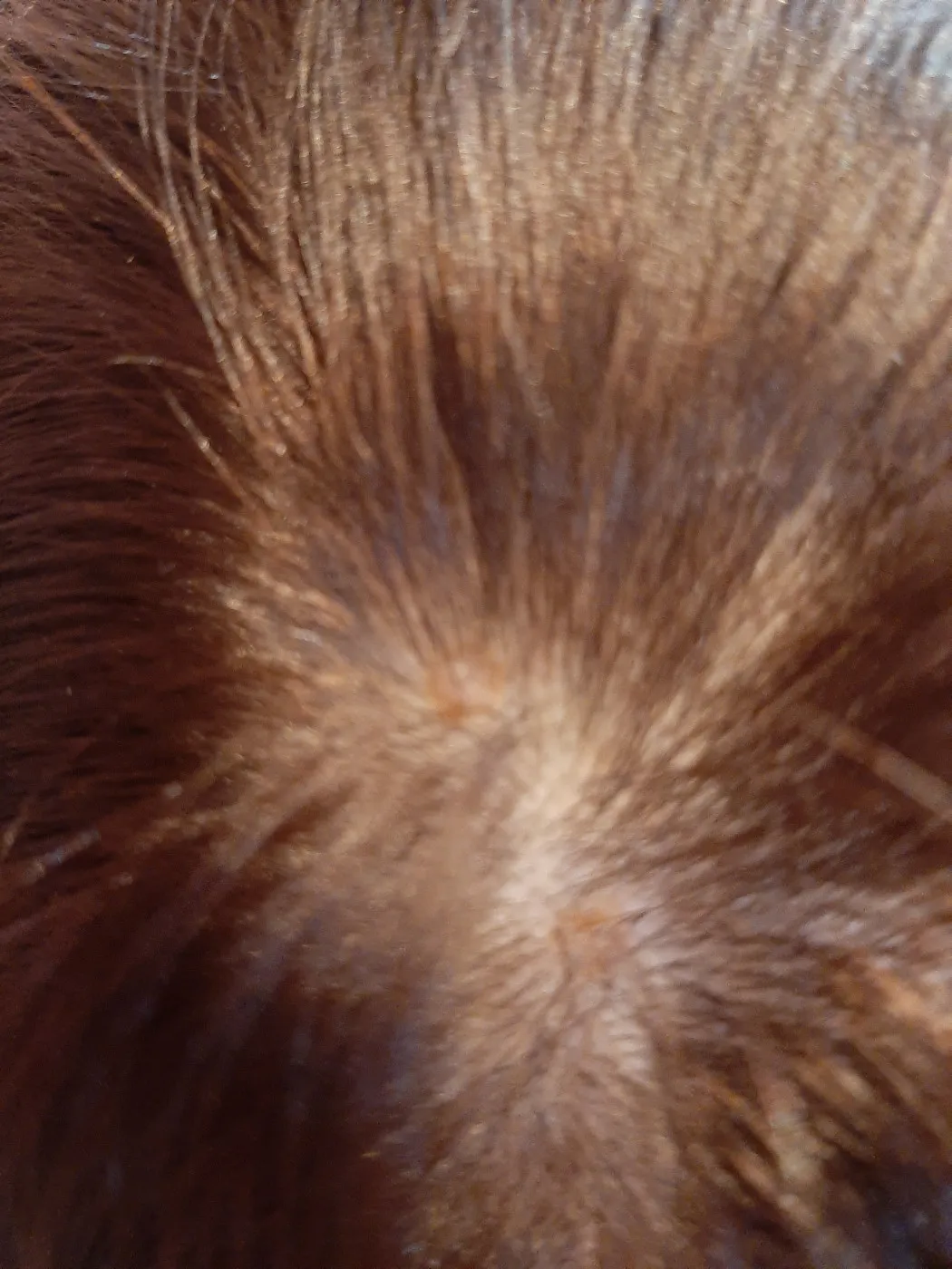 Грибок кожи головы: микроскопическое и клиническое изображение Визуализация грибка кожи головы под микроскопом и внешние проявления на коже: покраснение, шелушение