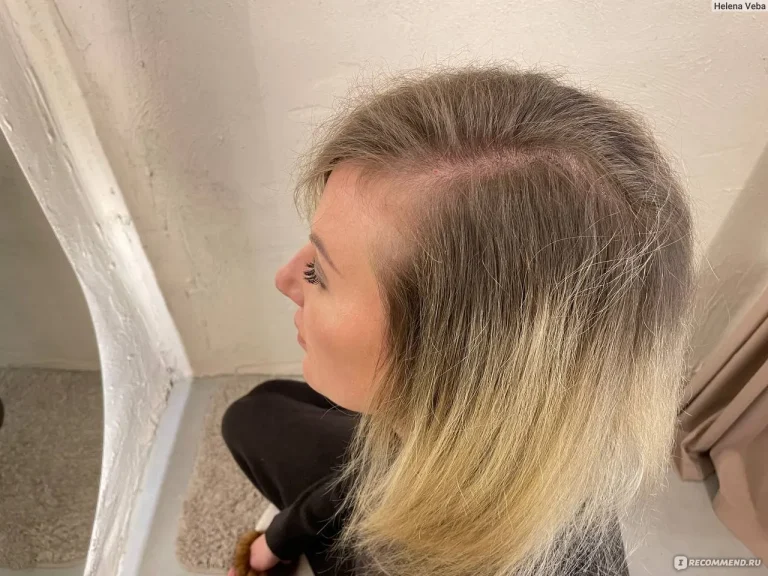 Здоровье и уход — Как остановить выпадение волос