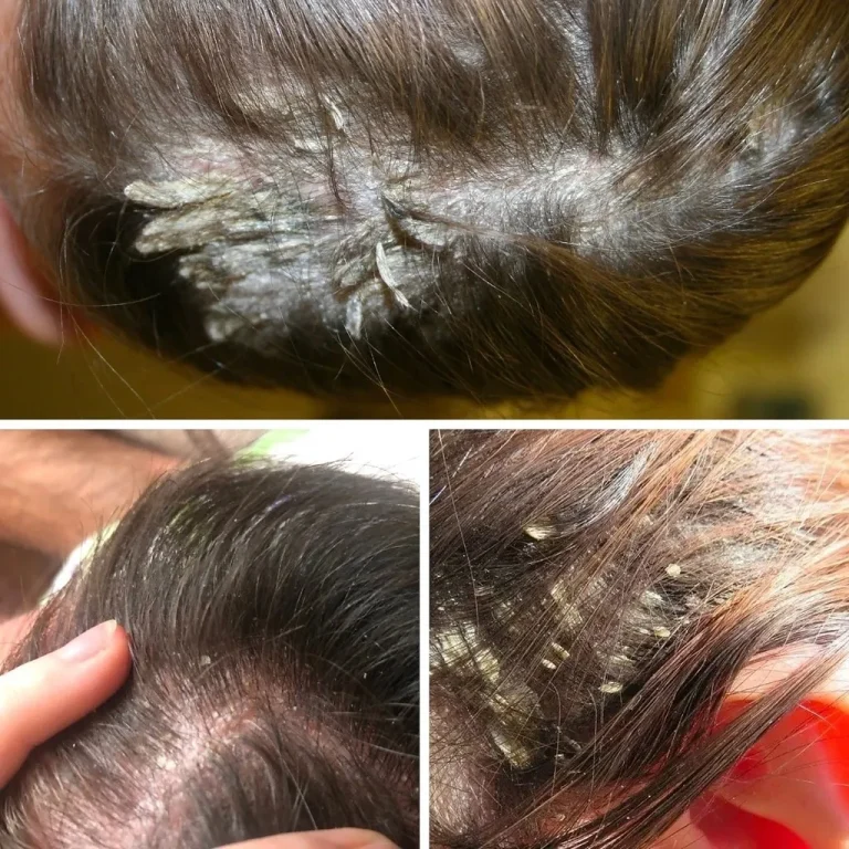 Здоровье и уход