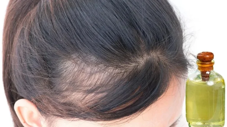 Здоровье и уход — Облысение