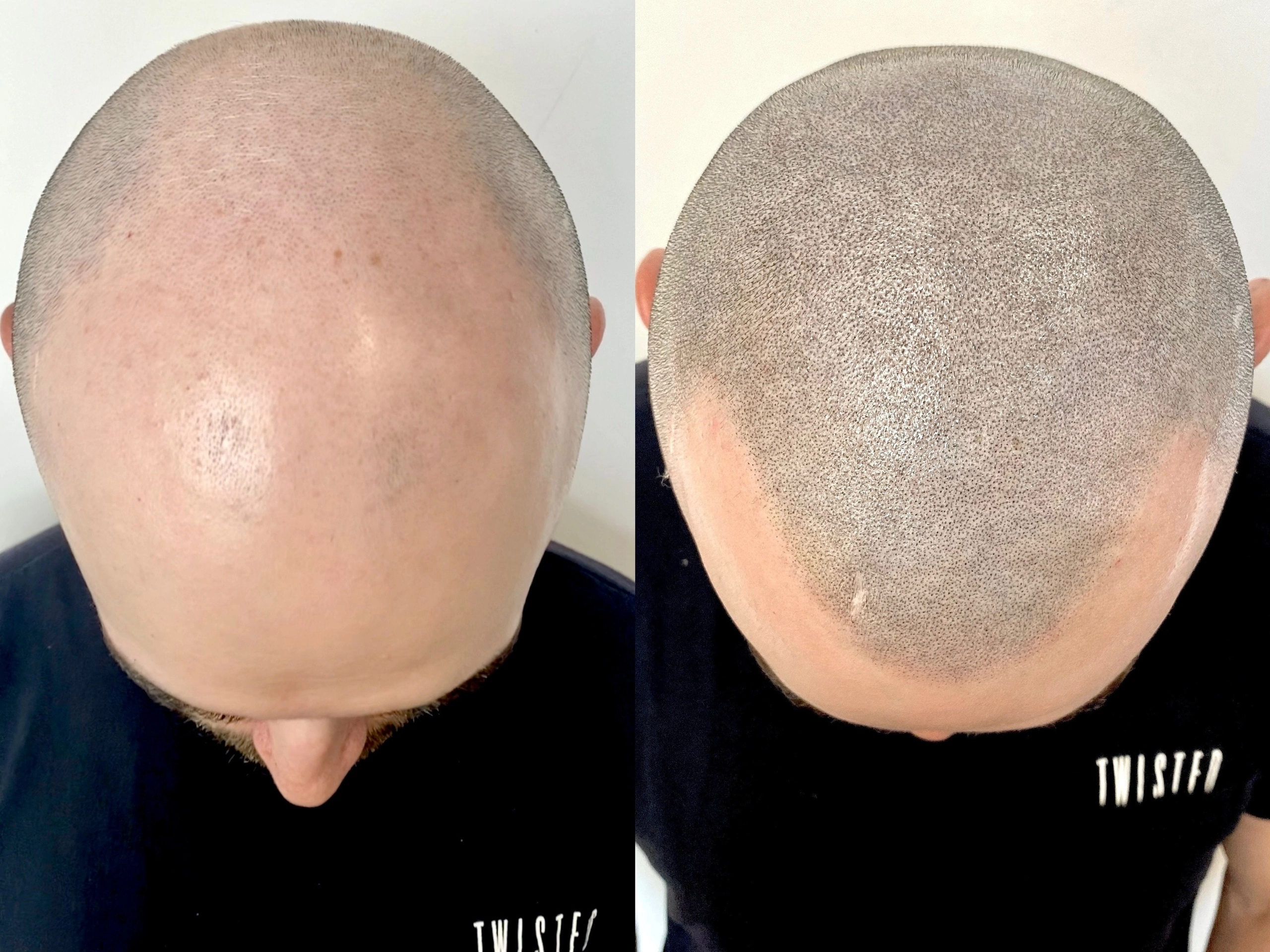 Сравнительный анализ: пигментация волос