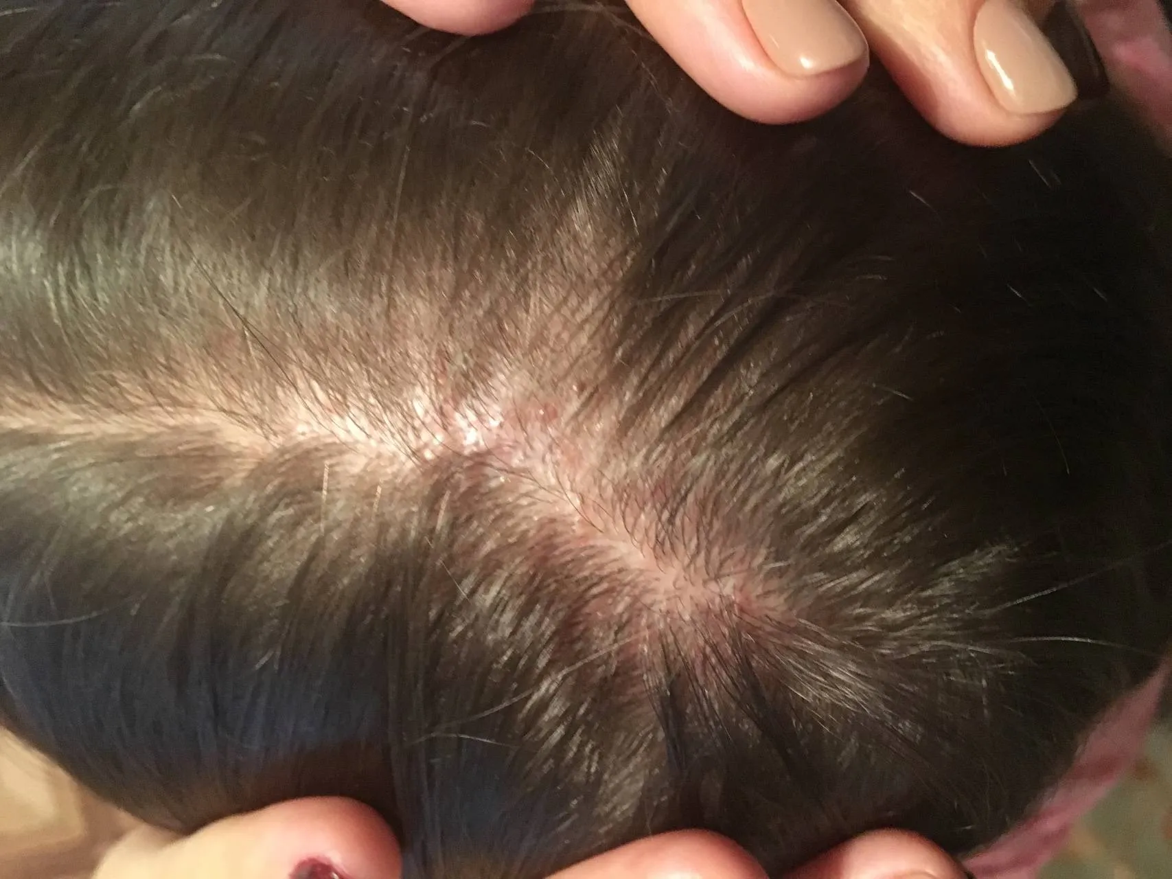 | Салон красоты | prichiny zuda kozhi golovy