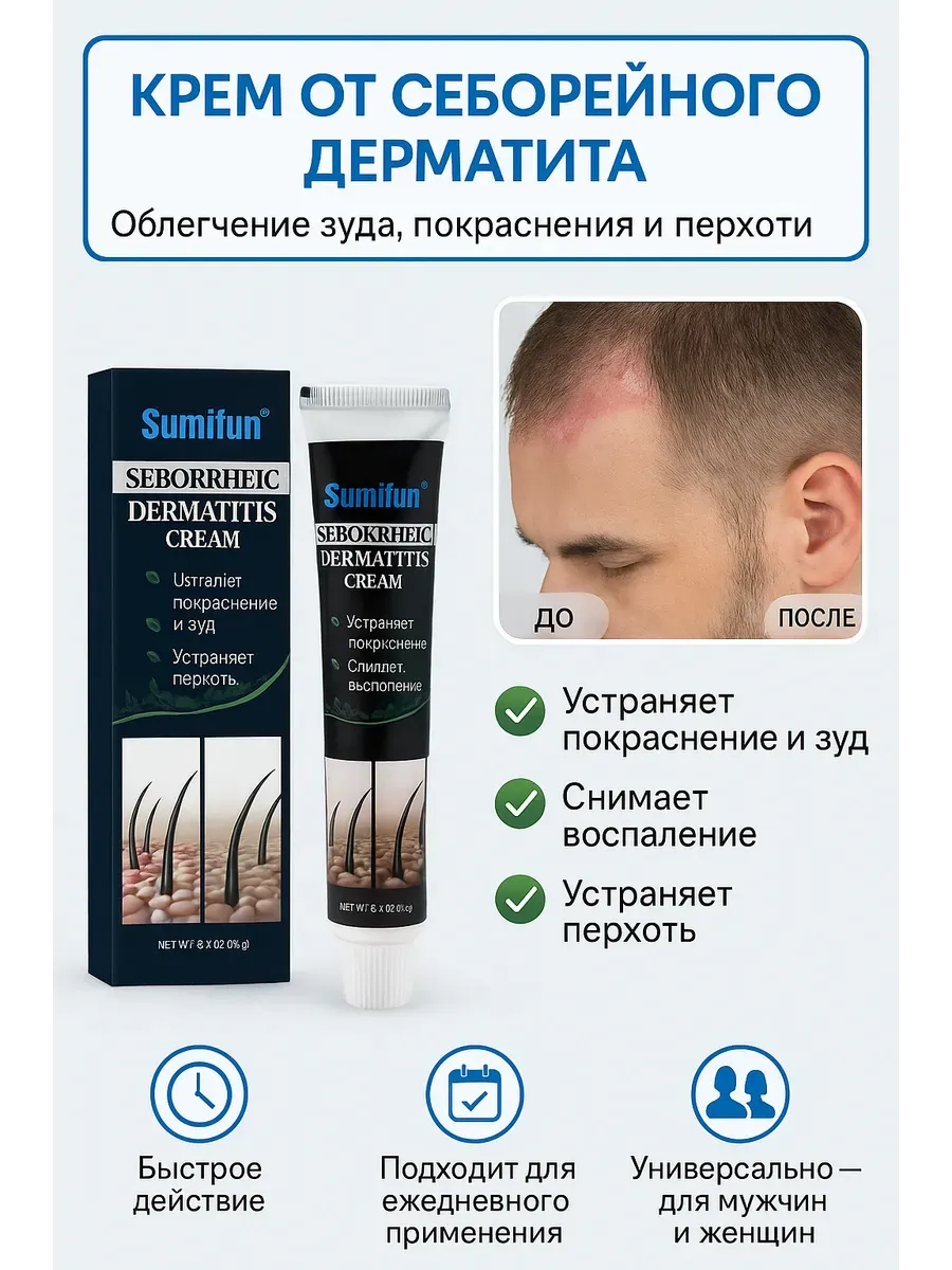 Сравнение эффективных методов и средств для лечения себореи кожи головы и избавления от перхоти