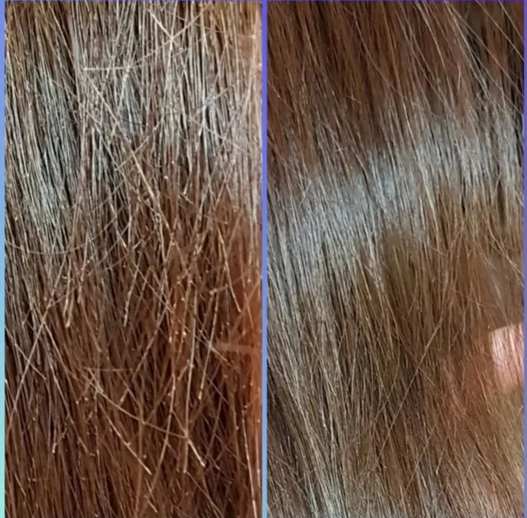 Визуальное объяснение: секущиеся волосы что делать