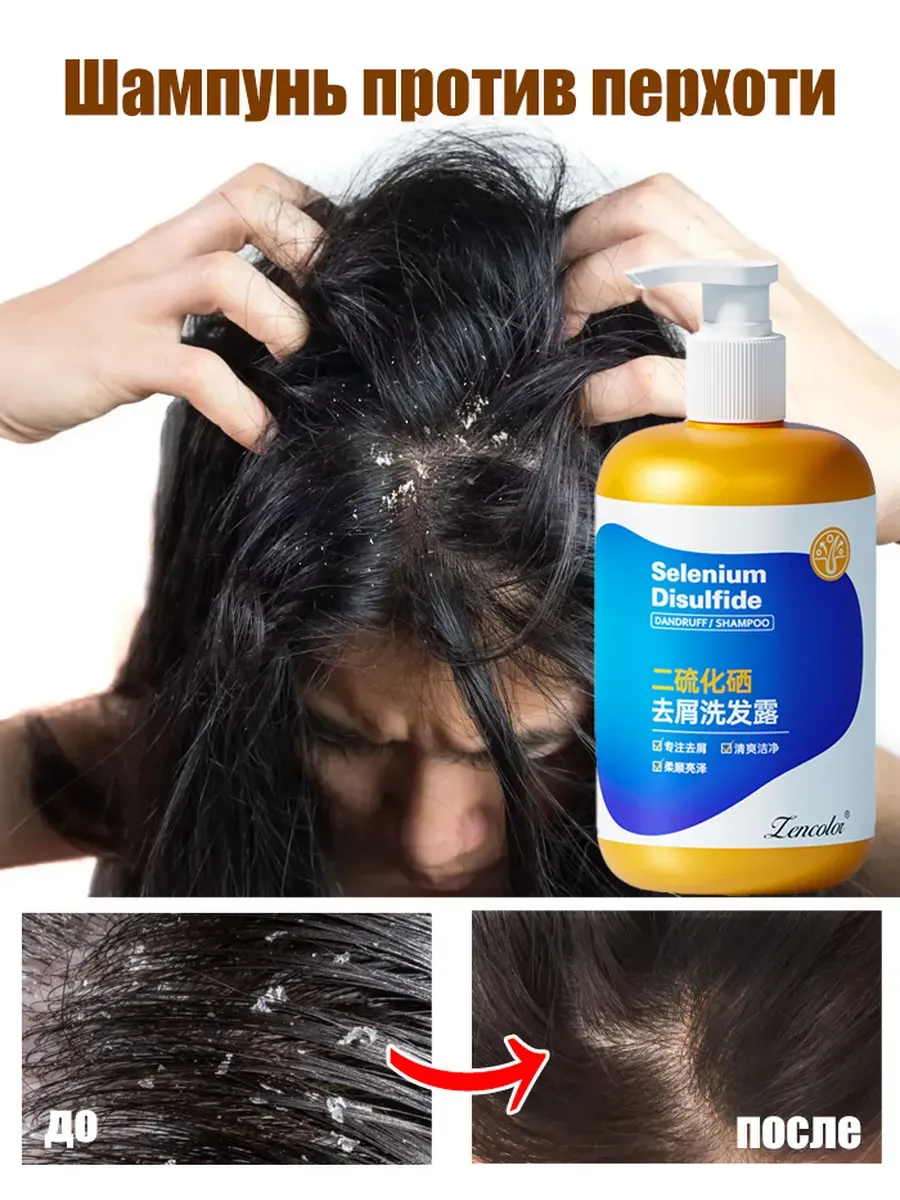 Визуальное руководство по: шампунь от зуда кожи головы
