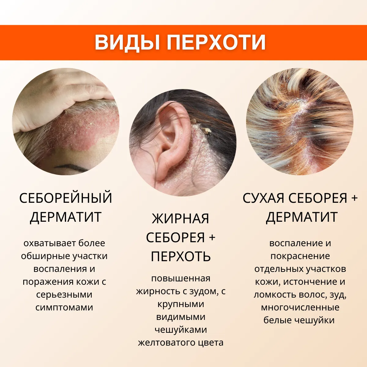 Визуальное руководство по: сильный зуд головы