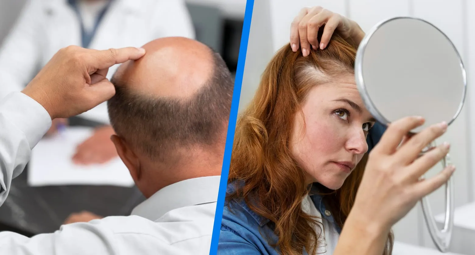 Визуальное руководство по: симптомы алопеции