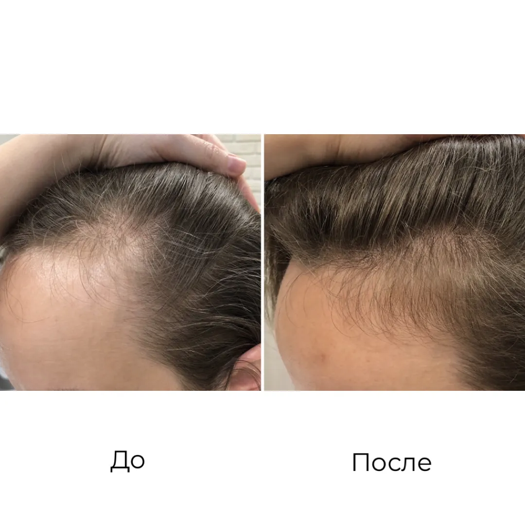 Актуальные новости: советы трихолога