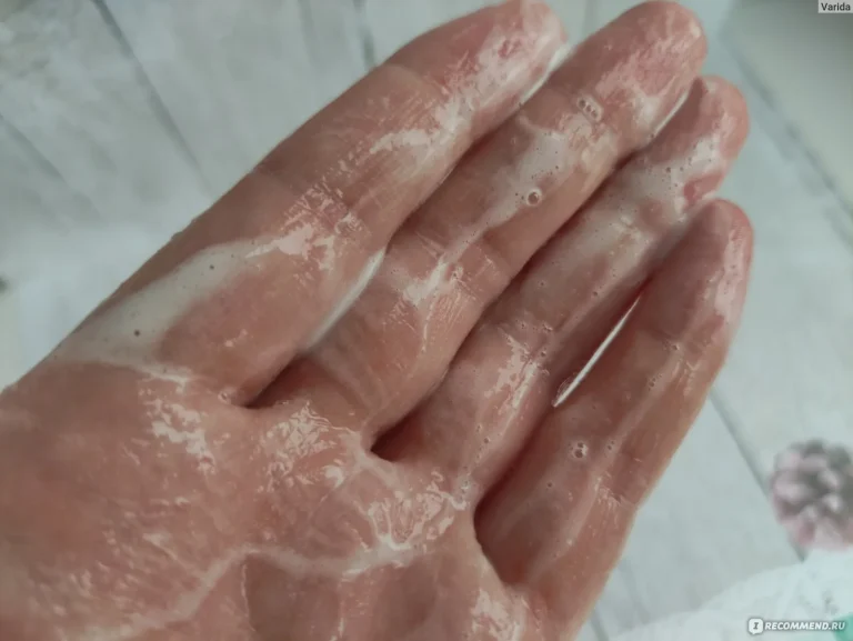 Уход за кожей головы — сухая кожа головы