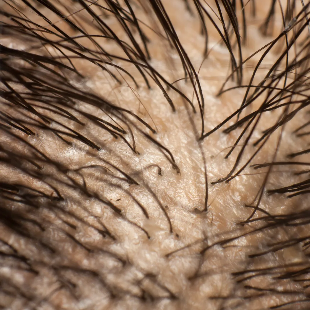 | Салон красоты | suhaya kozha golovy i volosy