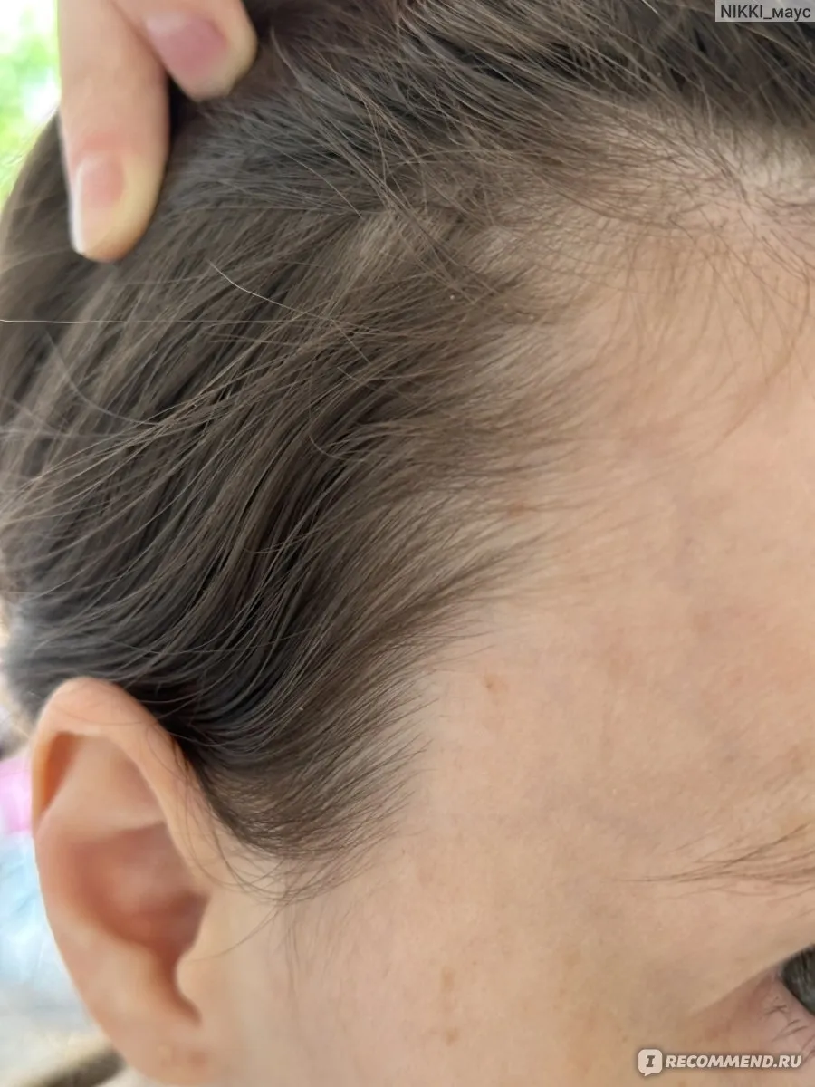 | Салон красоты | telogenovoe vypadenie volos