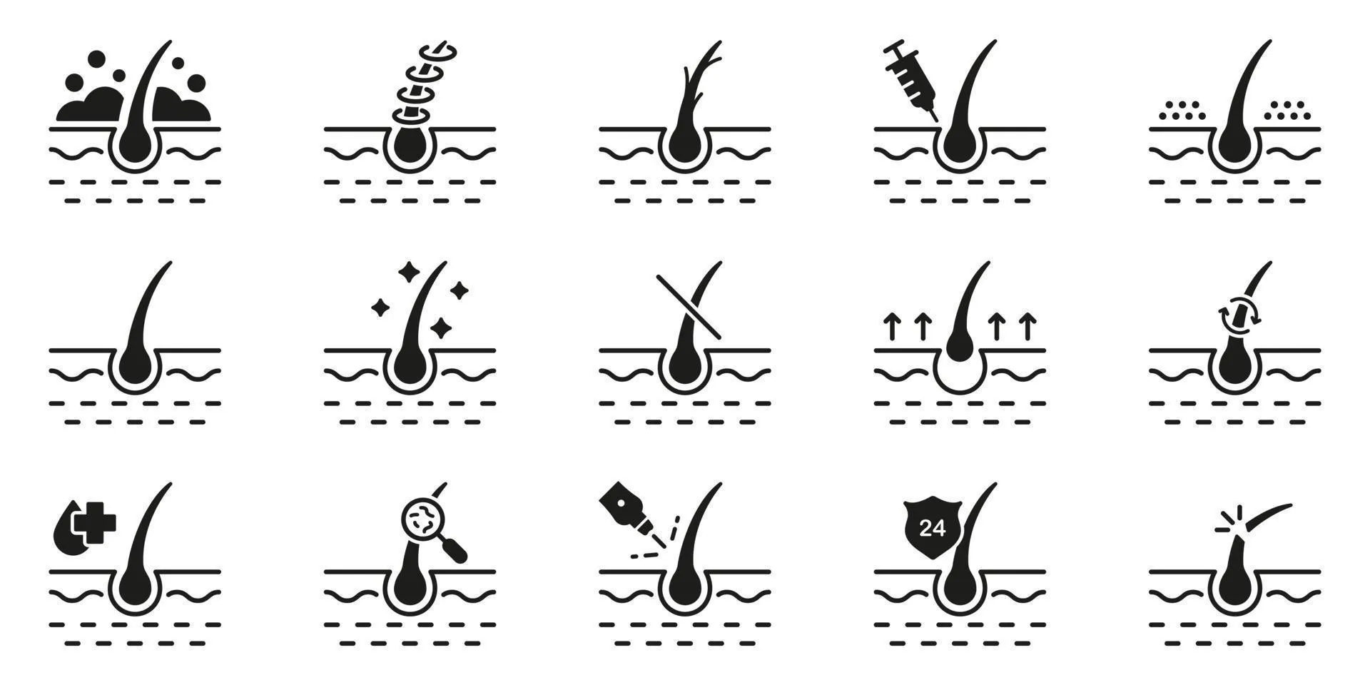 Визуальное объяснение: волосяная луковица