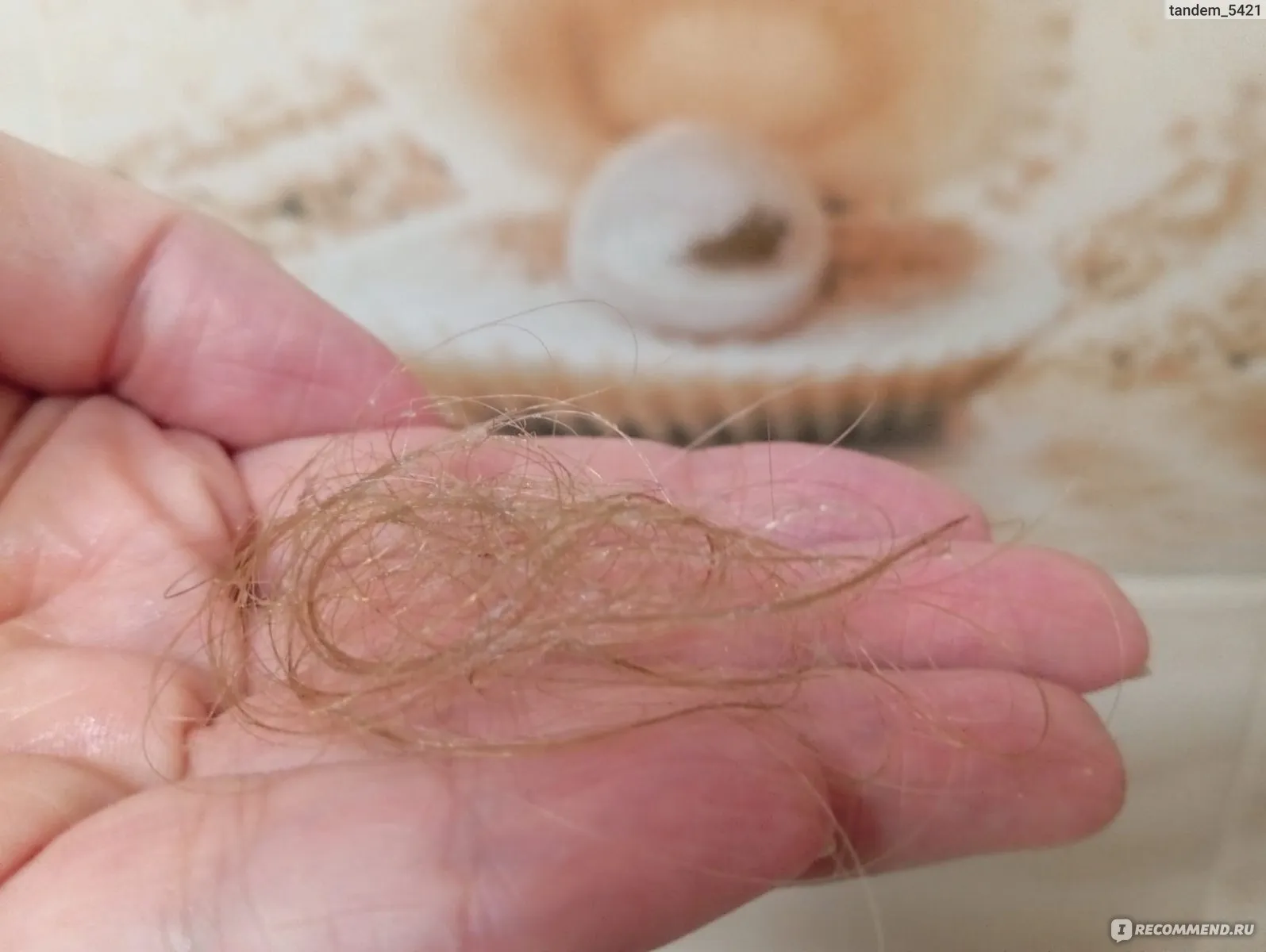 Актуальные новости: выпадение волос отзывы