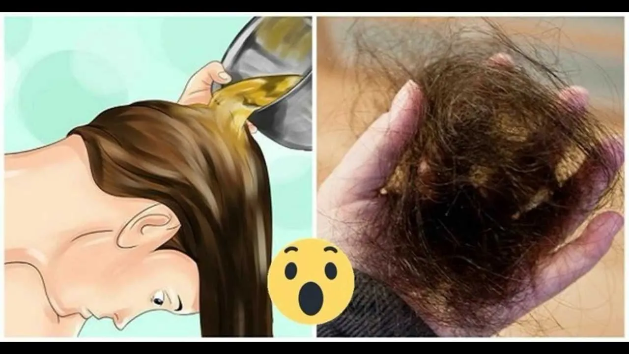 Актуальные новости: выпадение волос причины и лечение