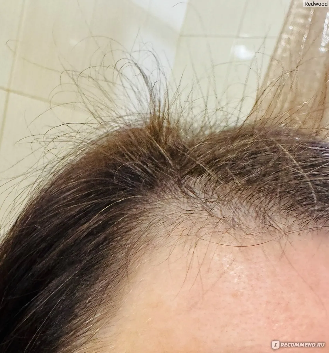 | Салон красоты | vypadenie volos