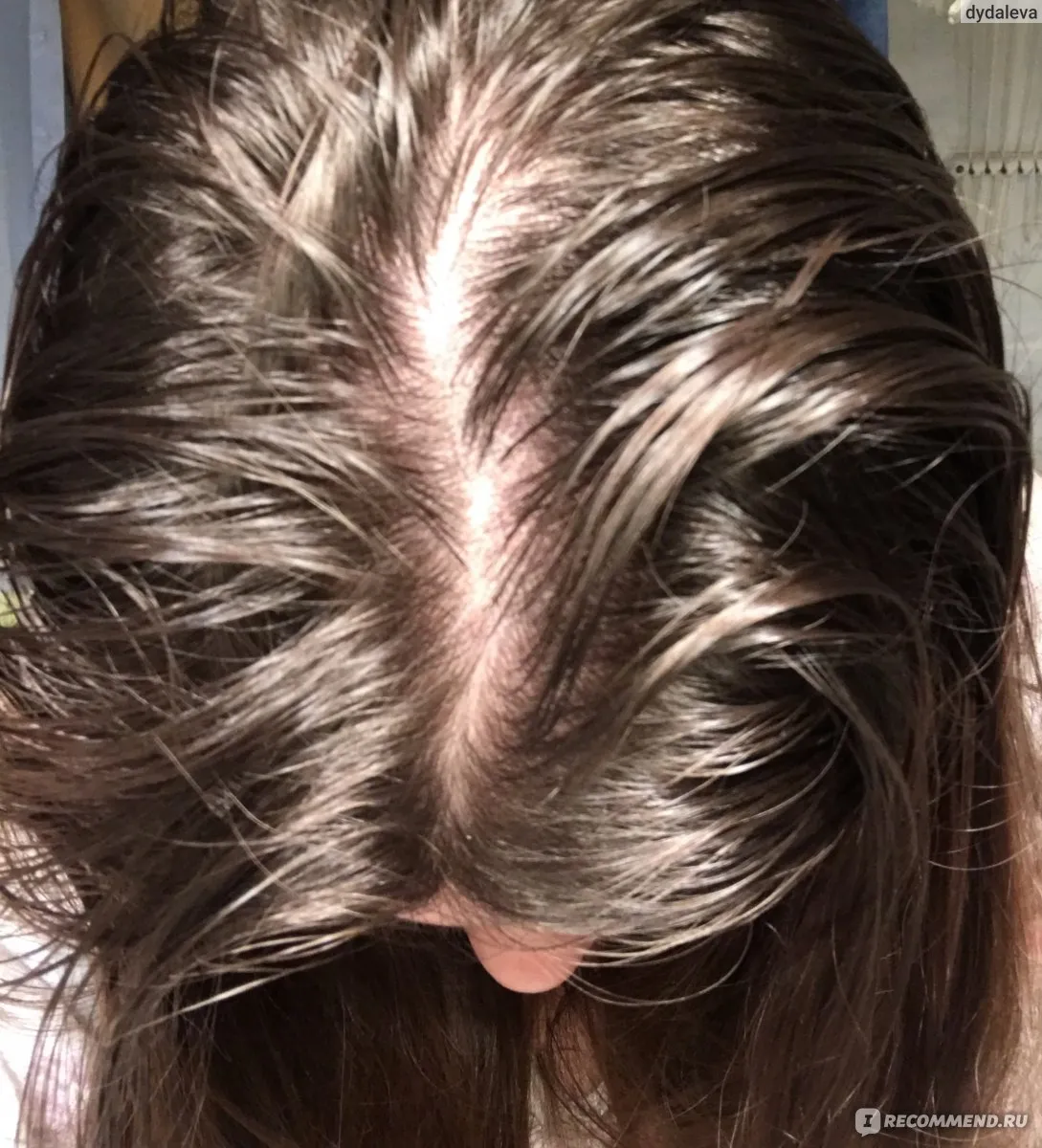 Визуальное руководство по: жирные волосы