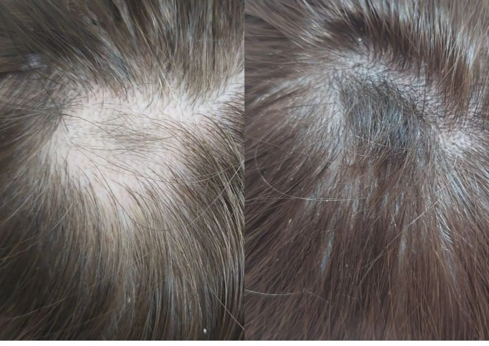 Актуальные новости: зуд кожи головы лечение