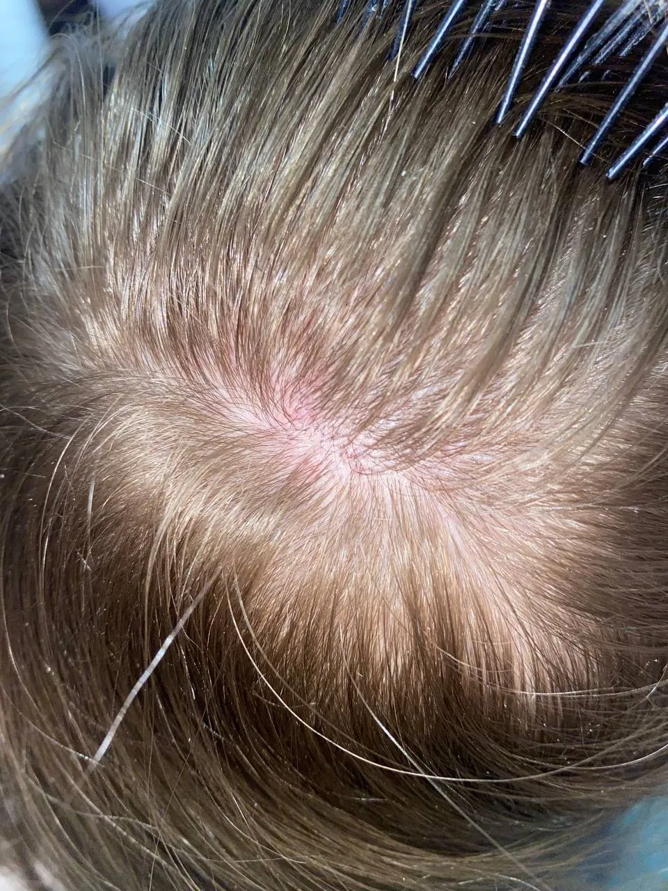 | Салон красоты | zud kozhi golovy