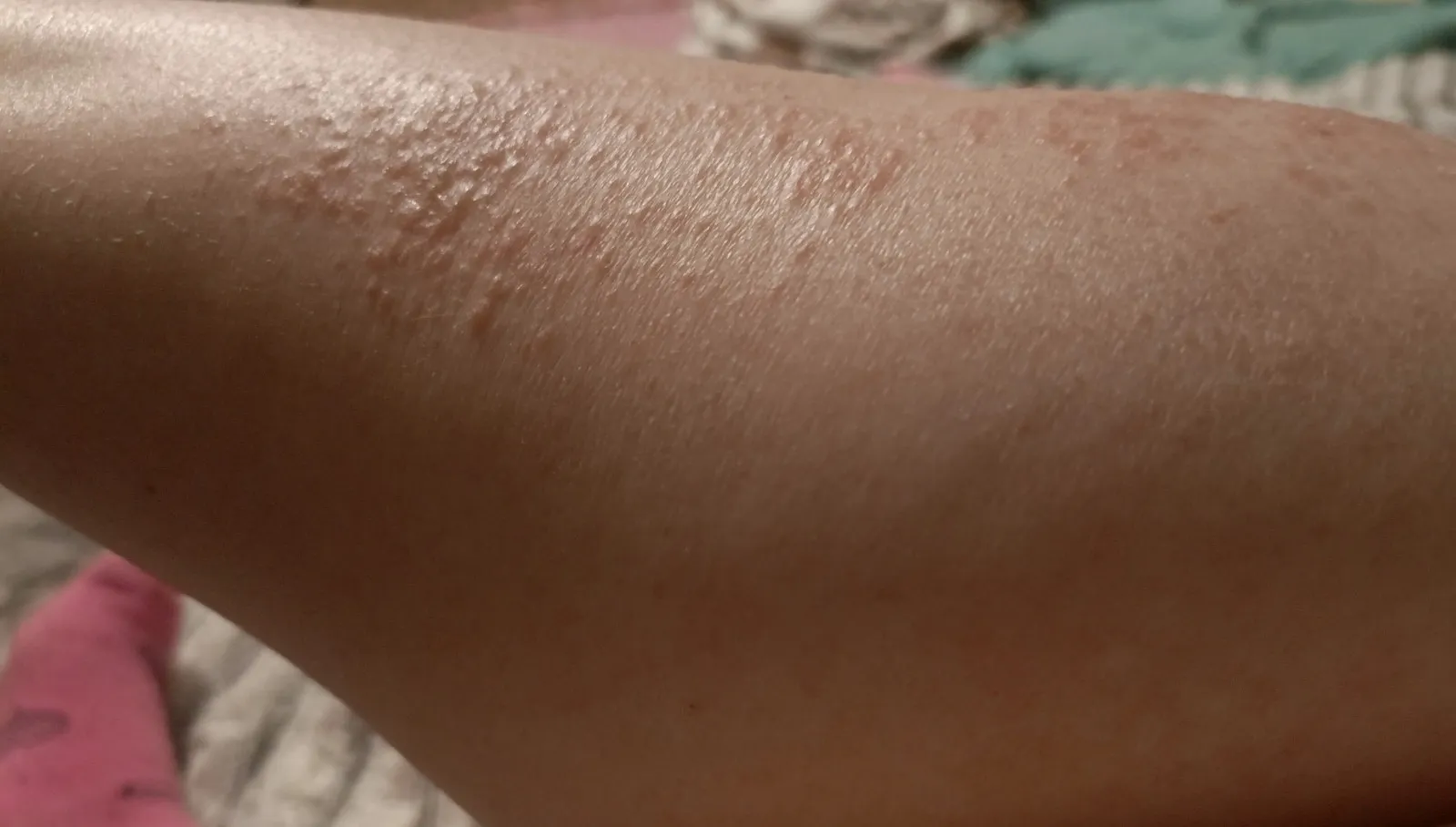 Актуальные новости: чешется кожа