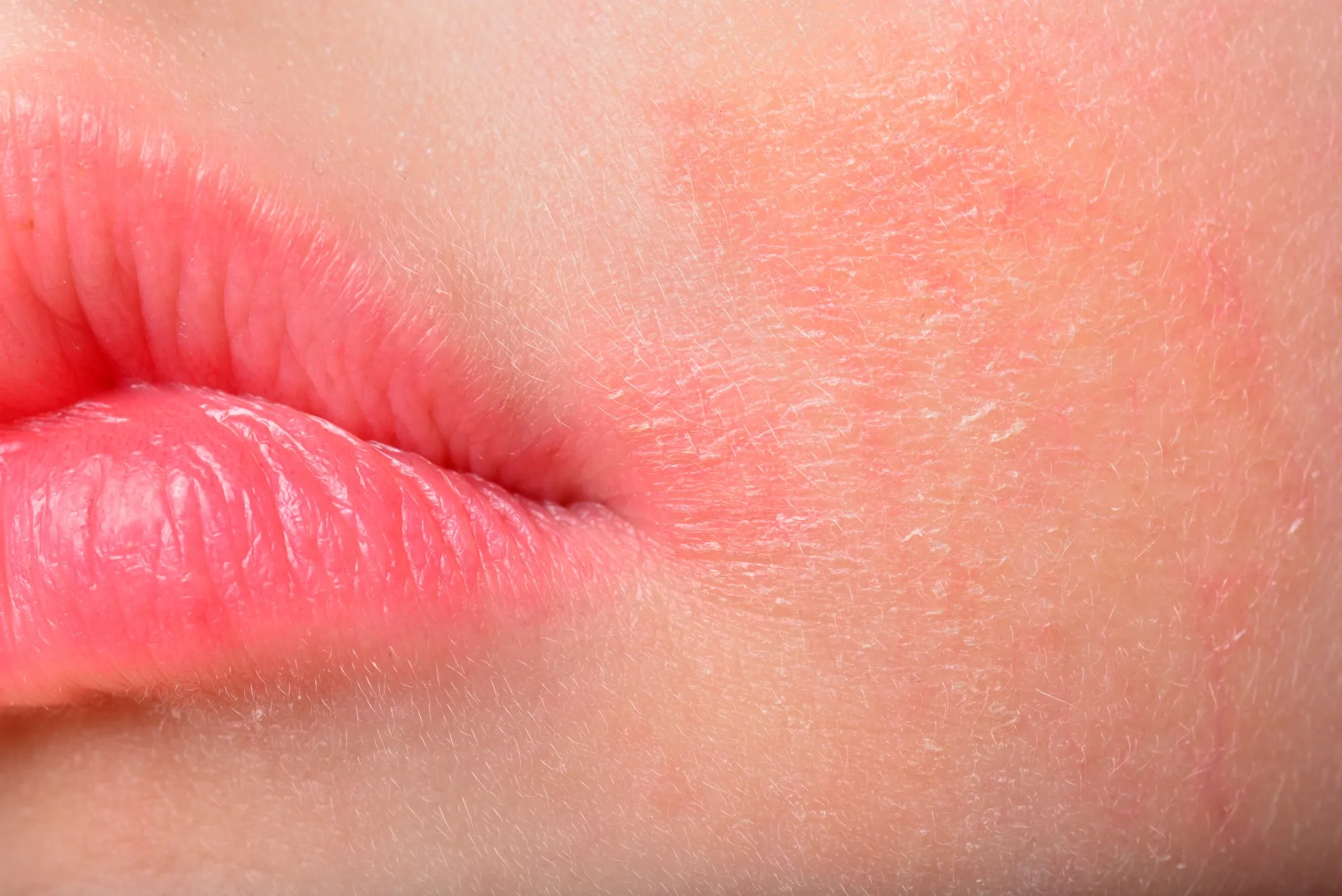 Актуальные новости: дерматит зуд