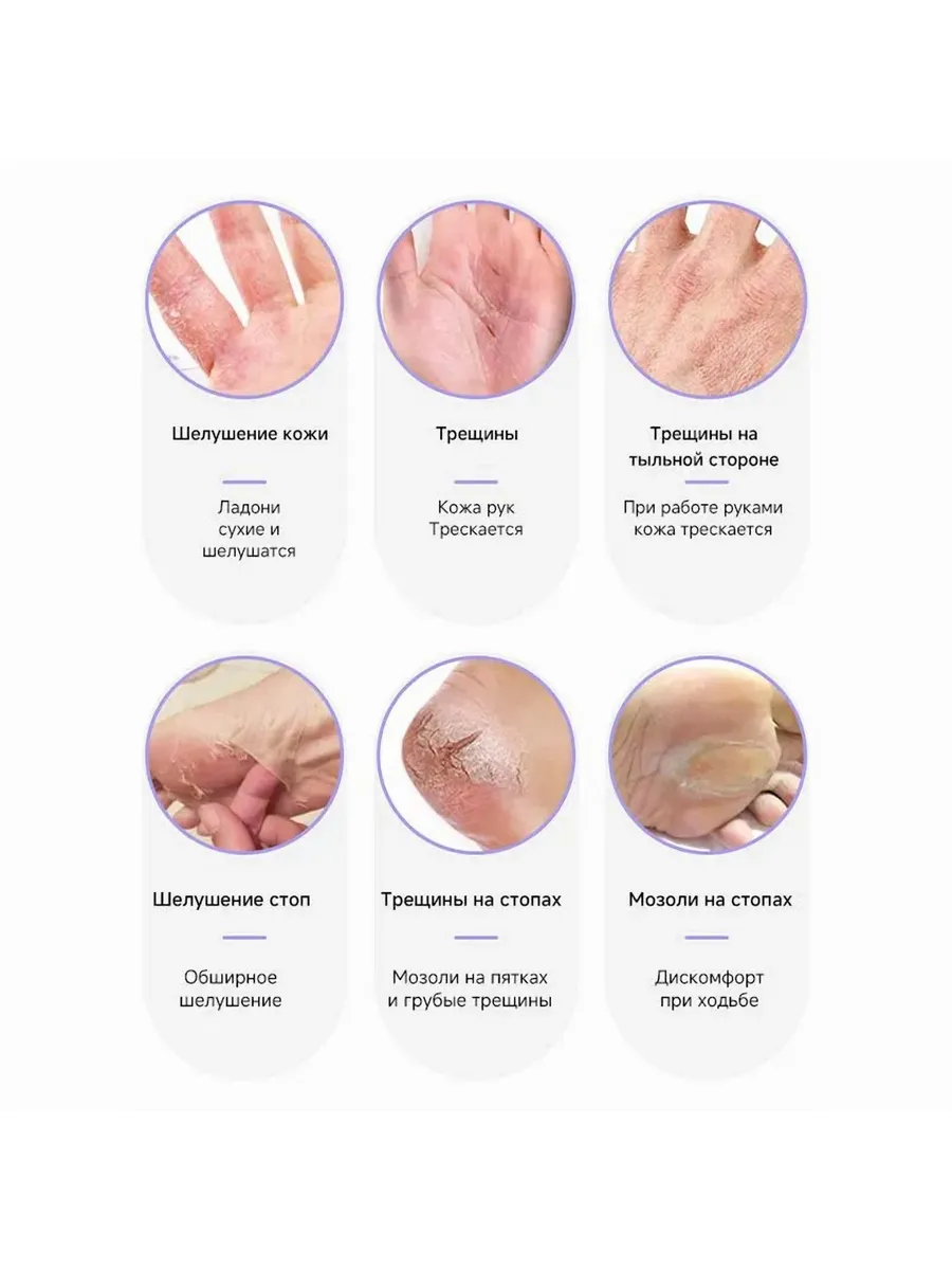 Актуальные новости: лечение шелушения кожи