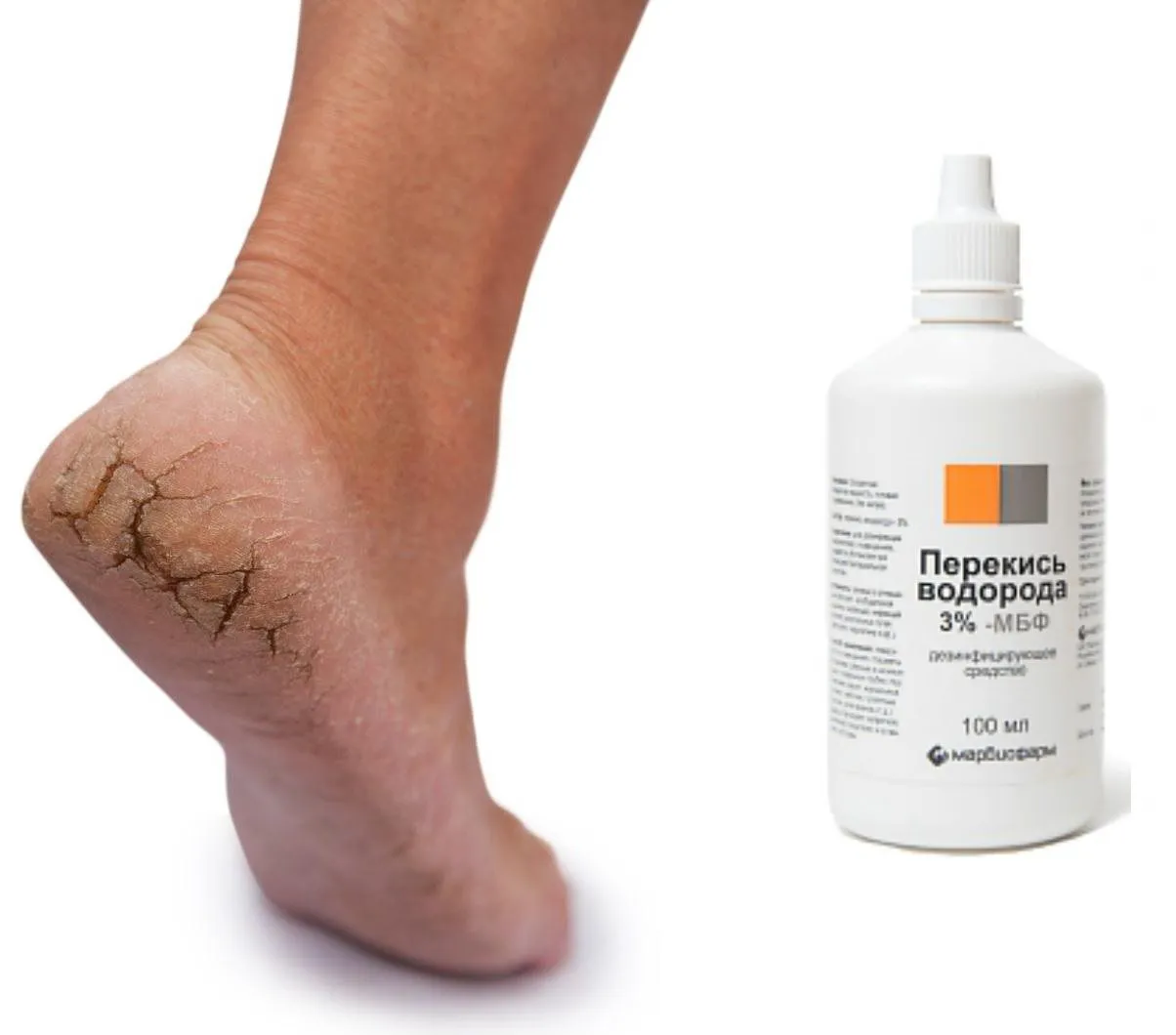 Эффективное лечение сухости кожи с помощью профессионального ухода и правильных косметических средств