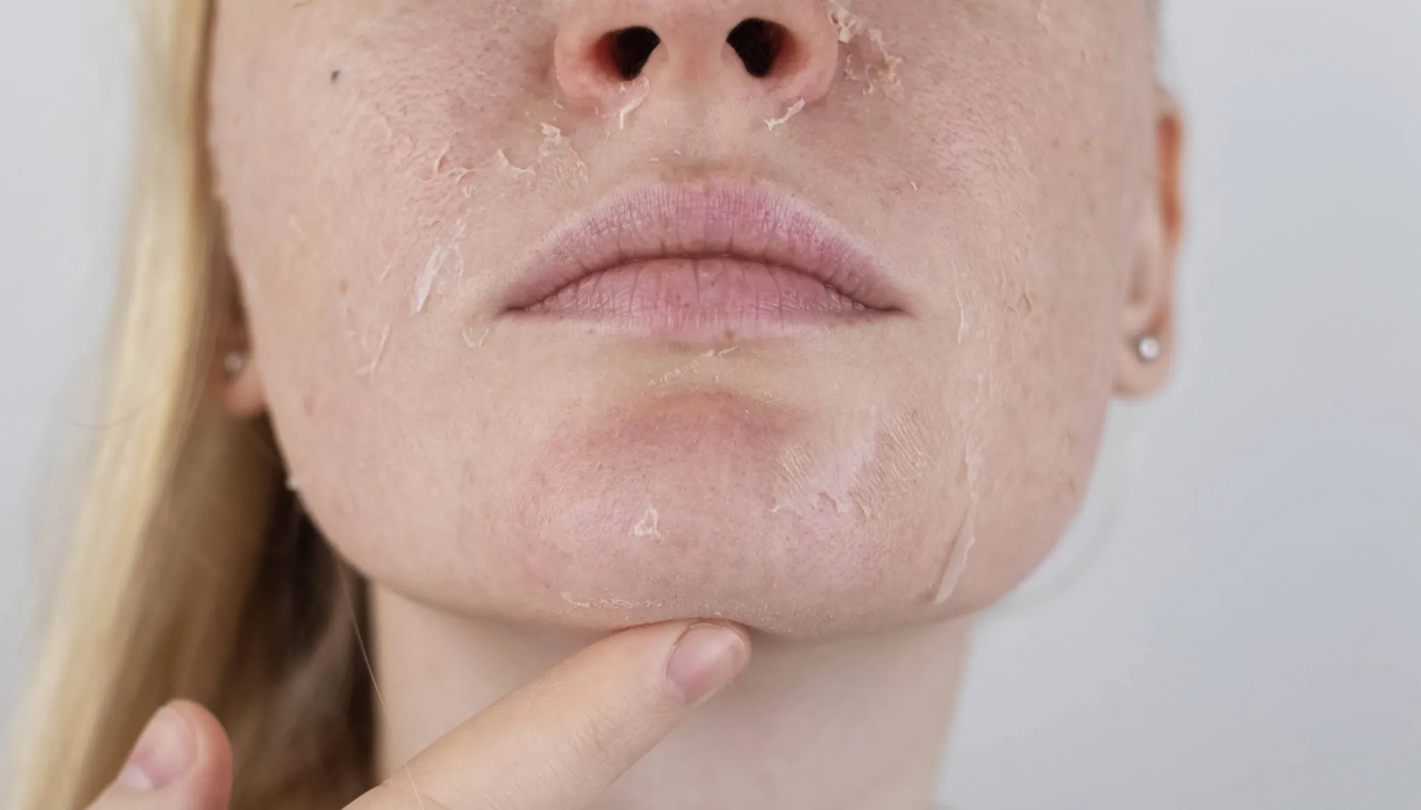 | Салон красоты | lechenie suhoy kozhi