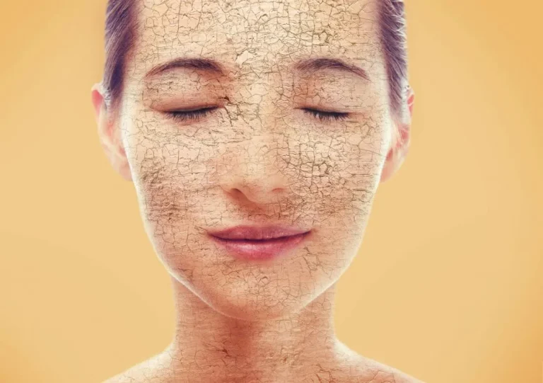 Уход за кожей — Обезвоживание кожи