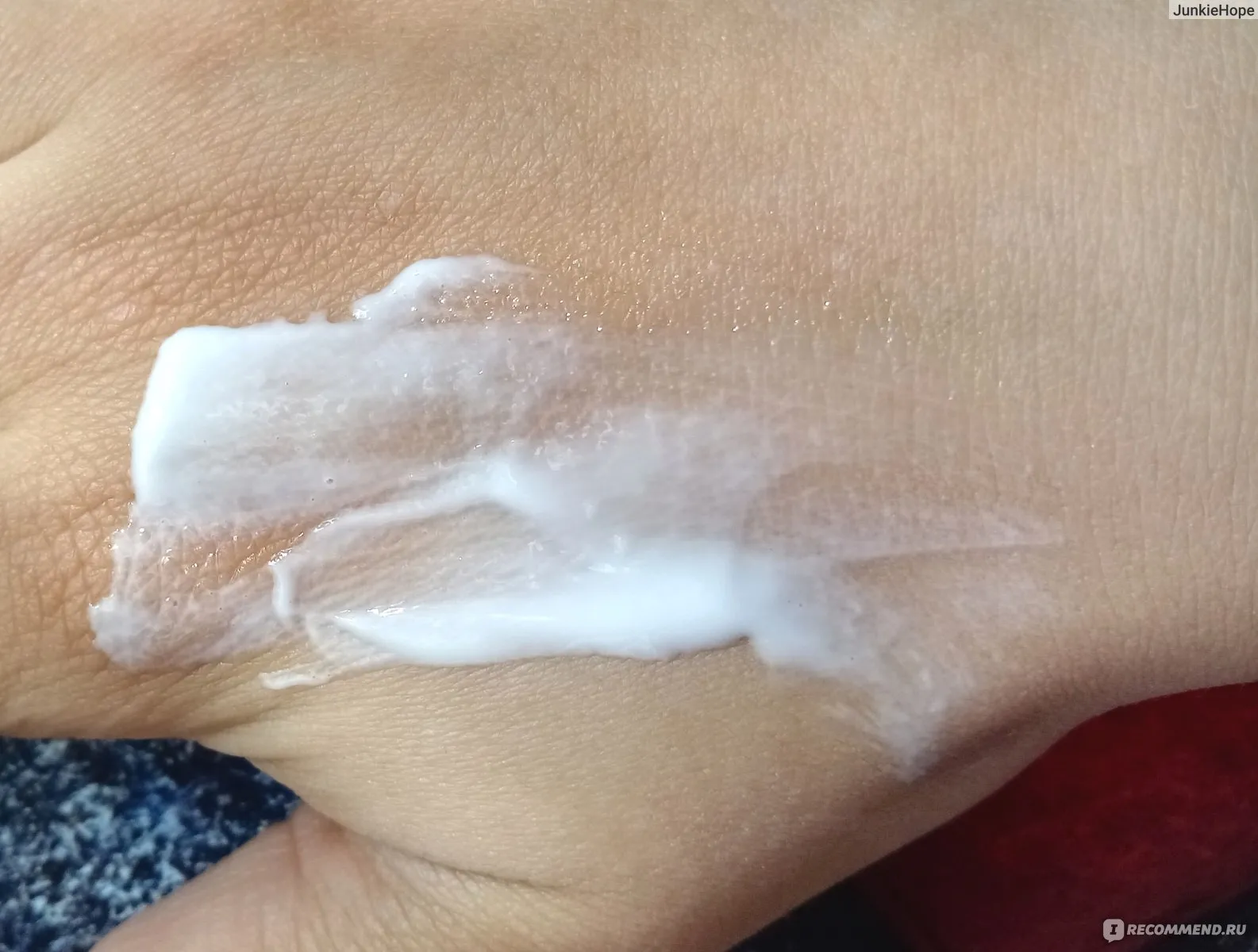 Визуальное руководство по: очень сухая кожа тела