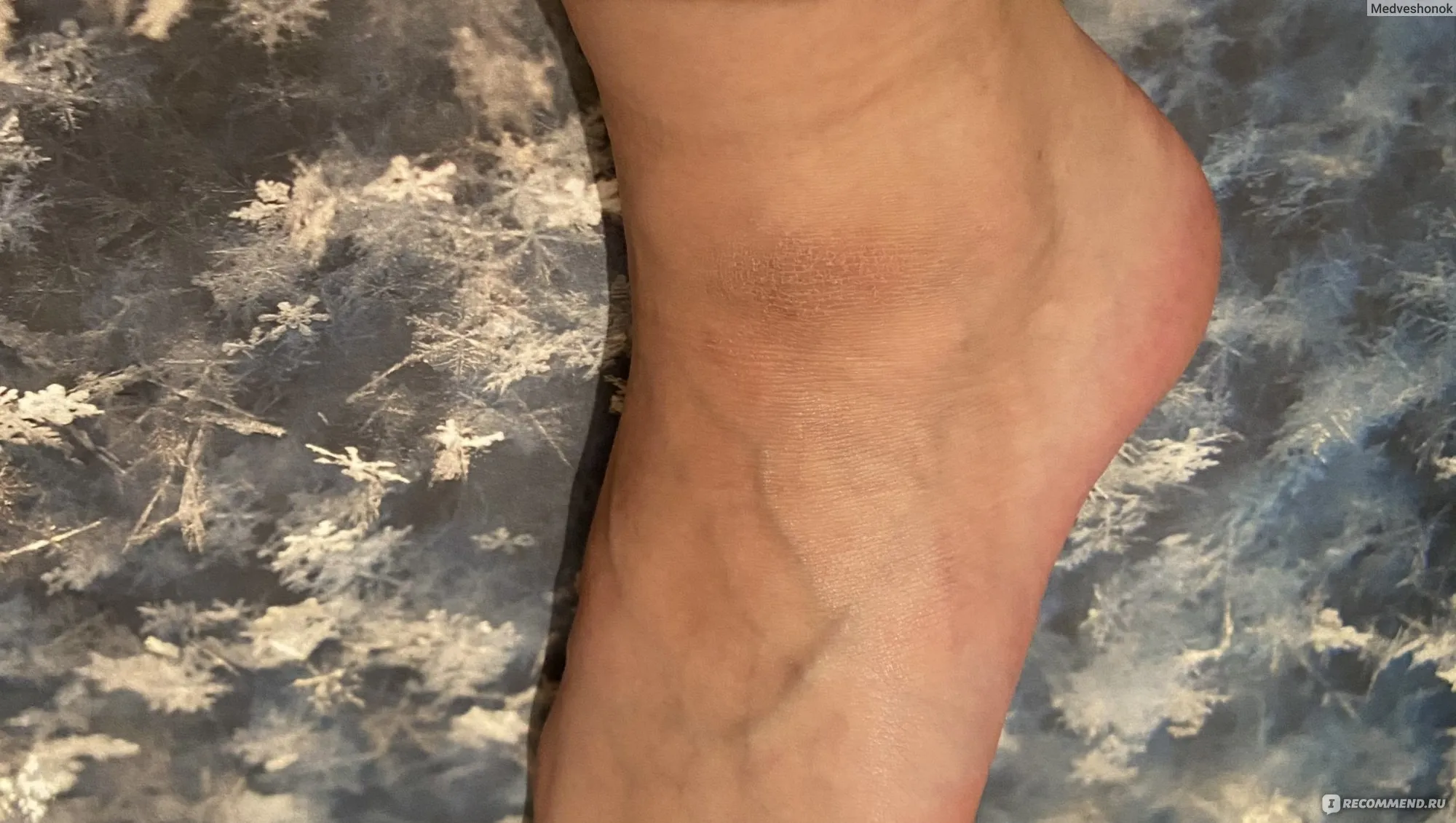 Актуальные новости: шелушение кожи на ногах