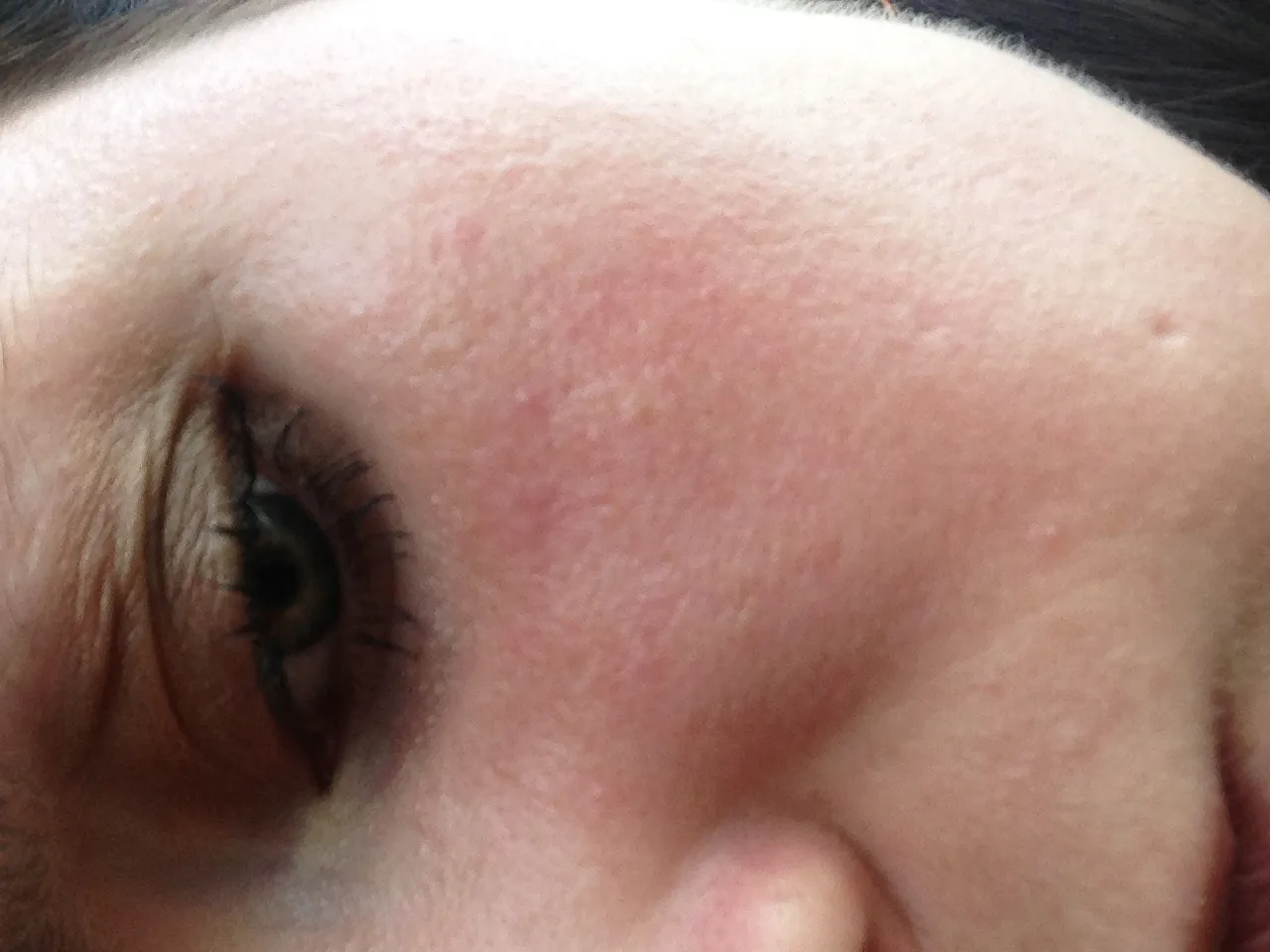 Визуальное руководство по: сухая чувствительная кожа