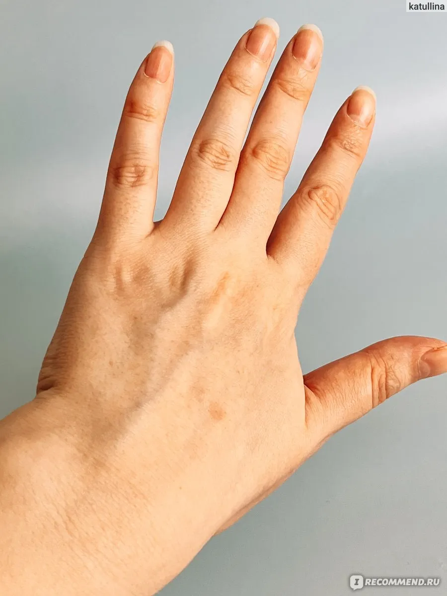 Сравнительный анализ: сухая кожа рук