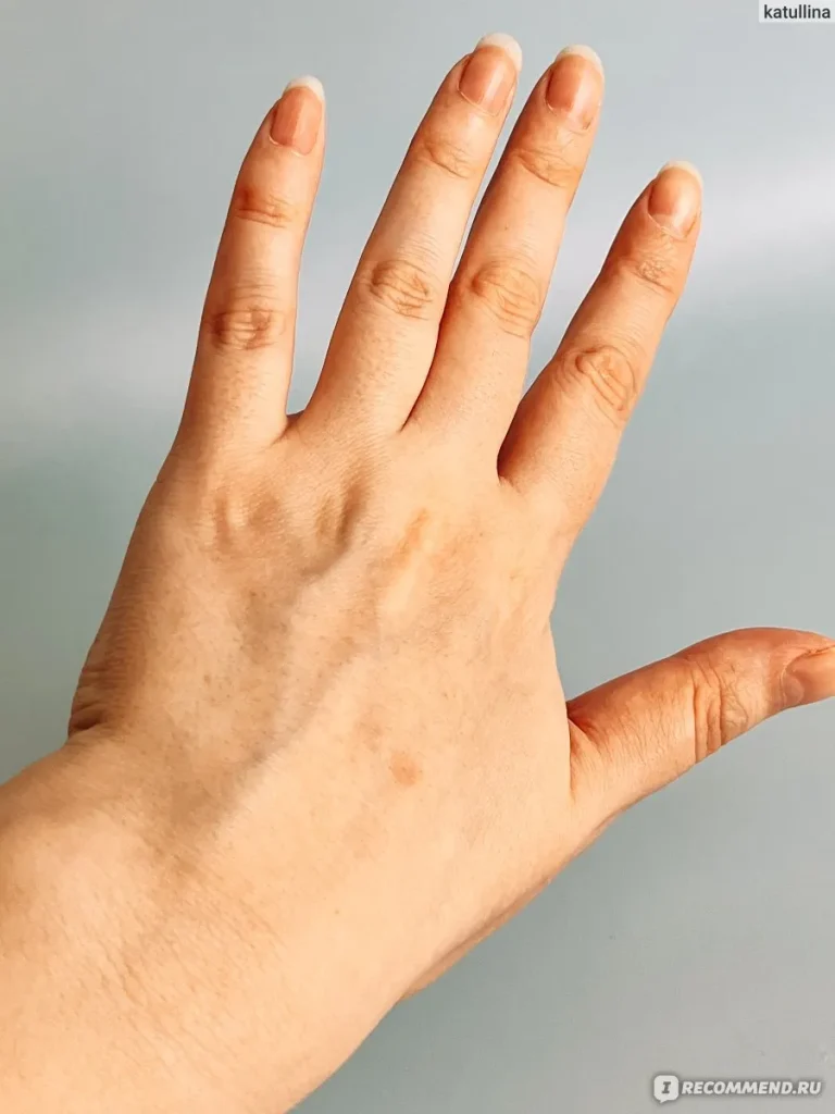Уход за кожей — Сухая кожа рук