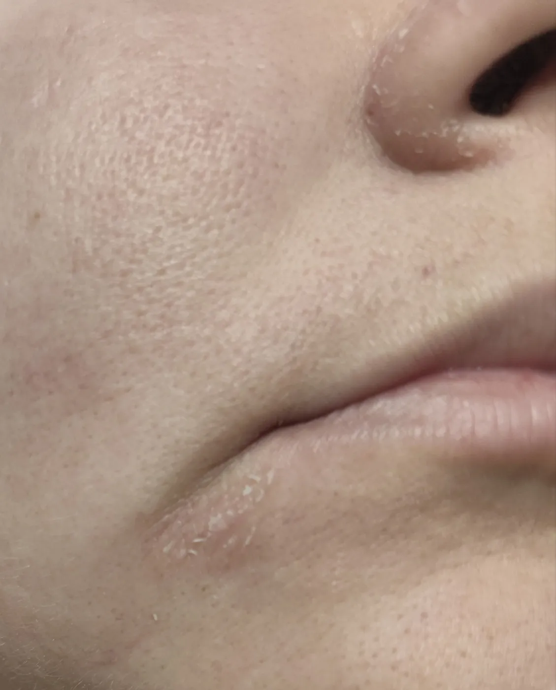 Визуальное объяснение: сухость кожи причины