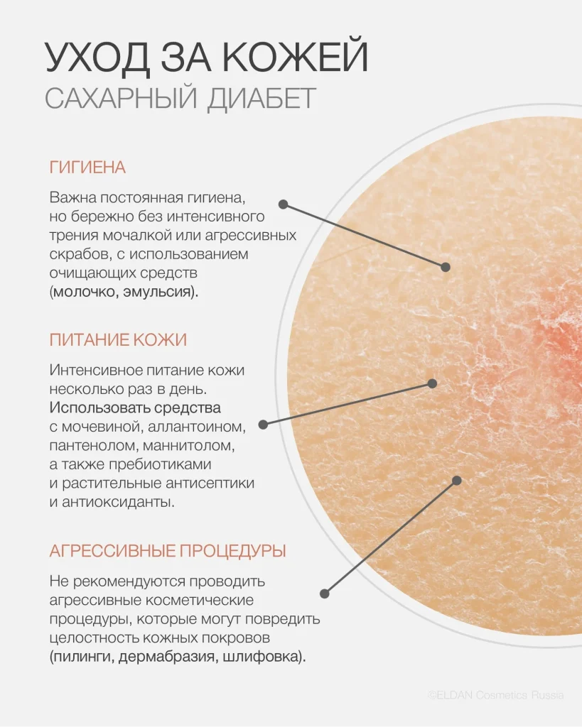 Уход за кожей — Уход за сухой кожей