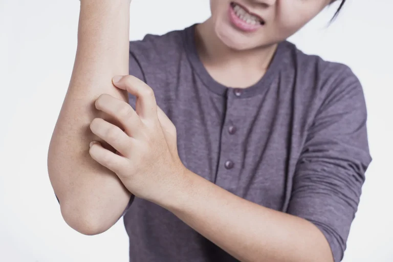 Здоровье и медицина — Зуд кожи