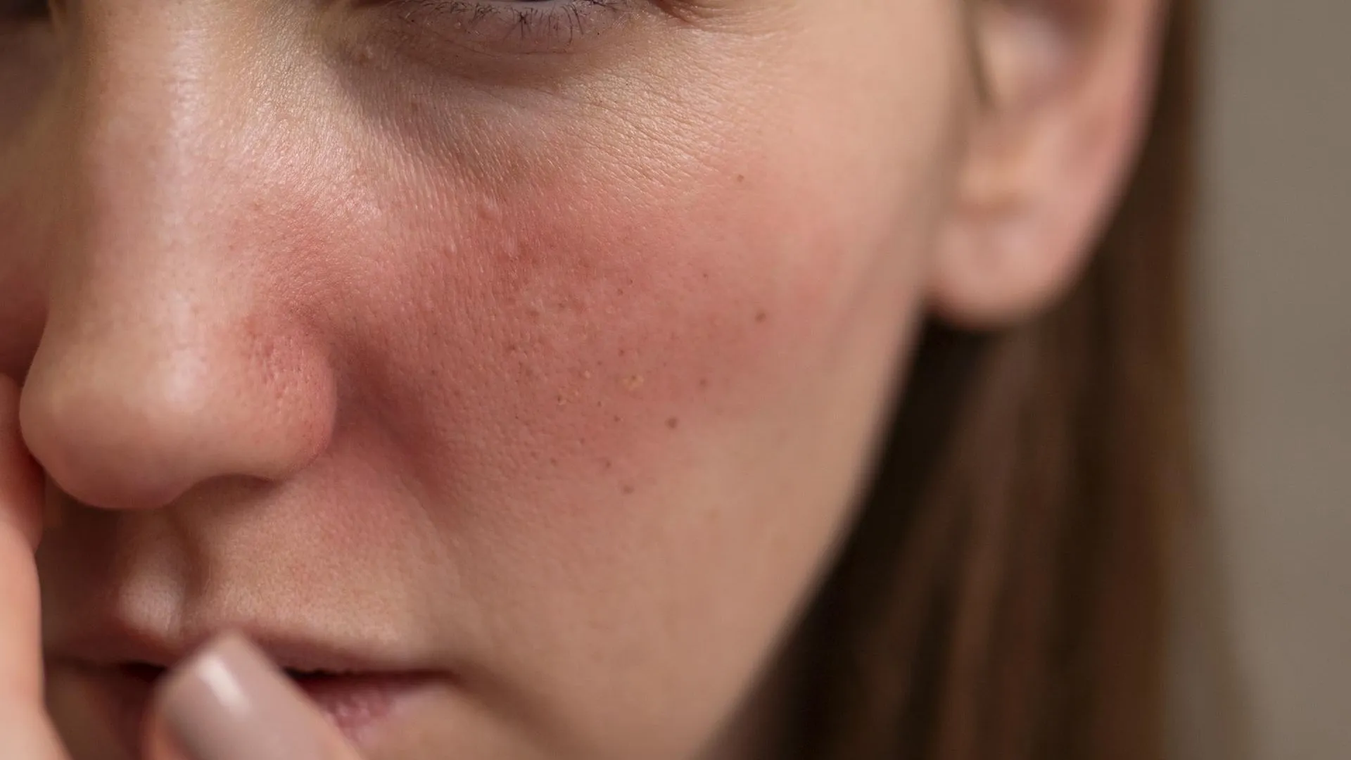 Визуальное руководство по: зуд кожи лица