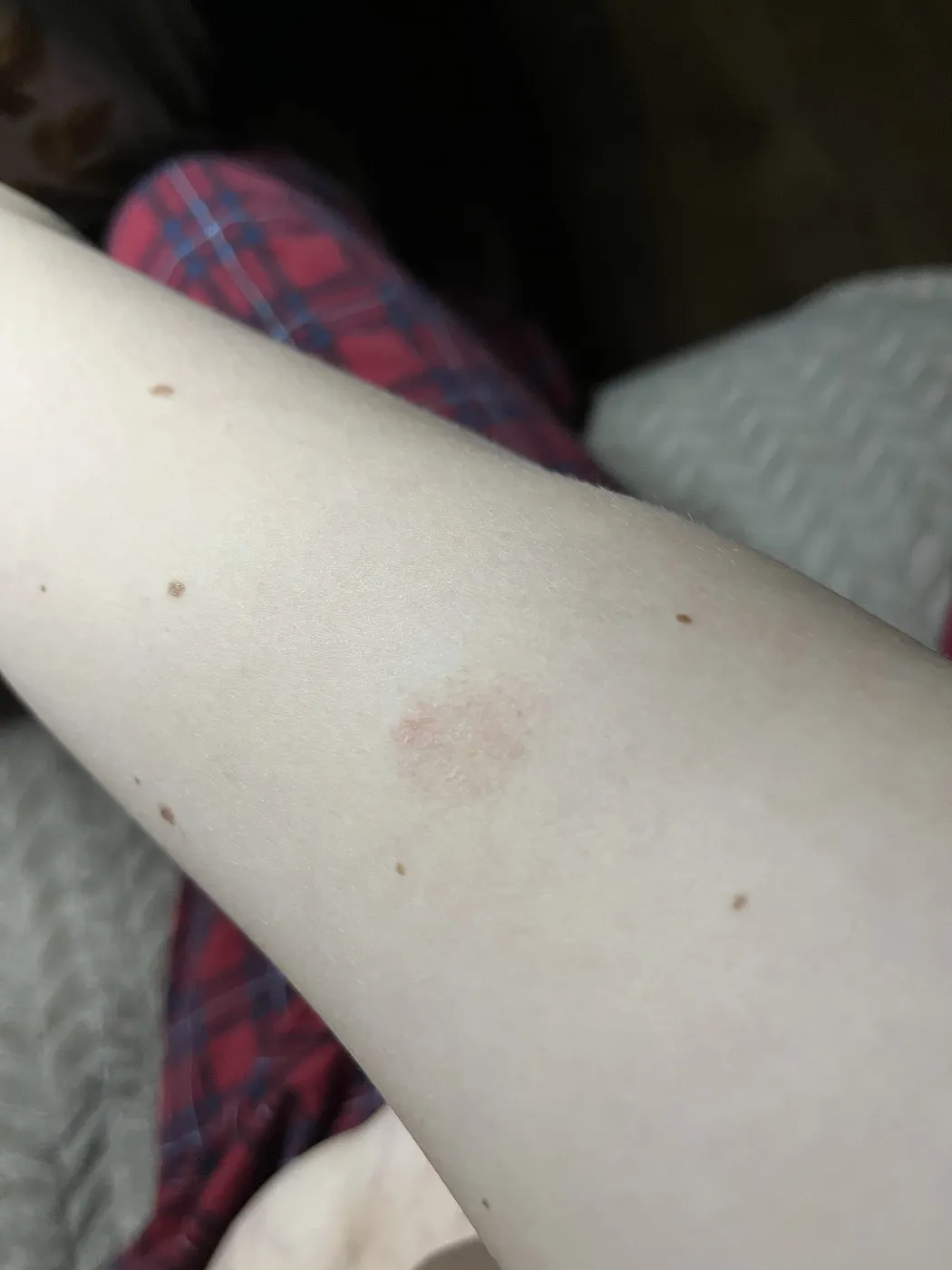 Актуальные новости: зуд кожи ног