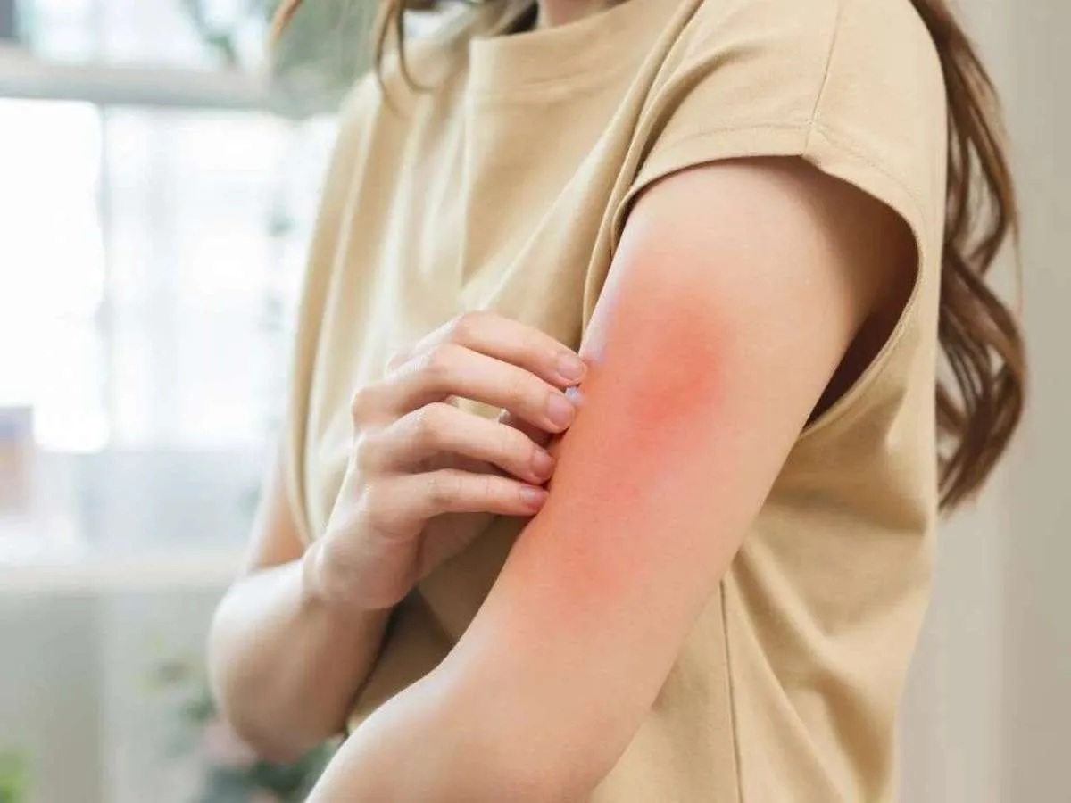 Визуальное руководство по: зуд кожи у взрослых