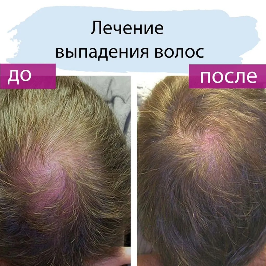 | Салон красоты | alopetsiya prichiny i lechenie
