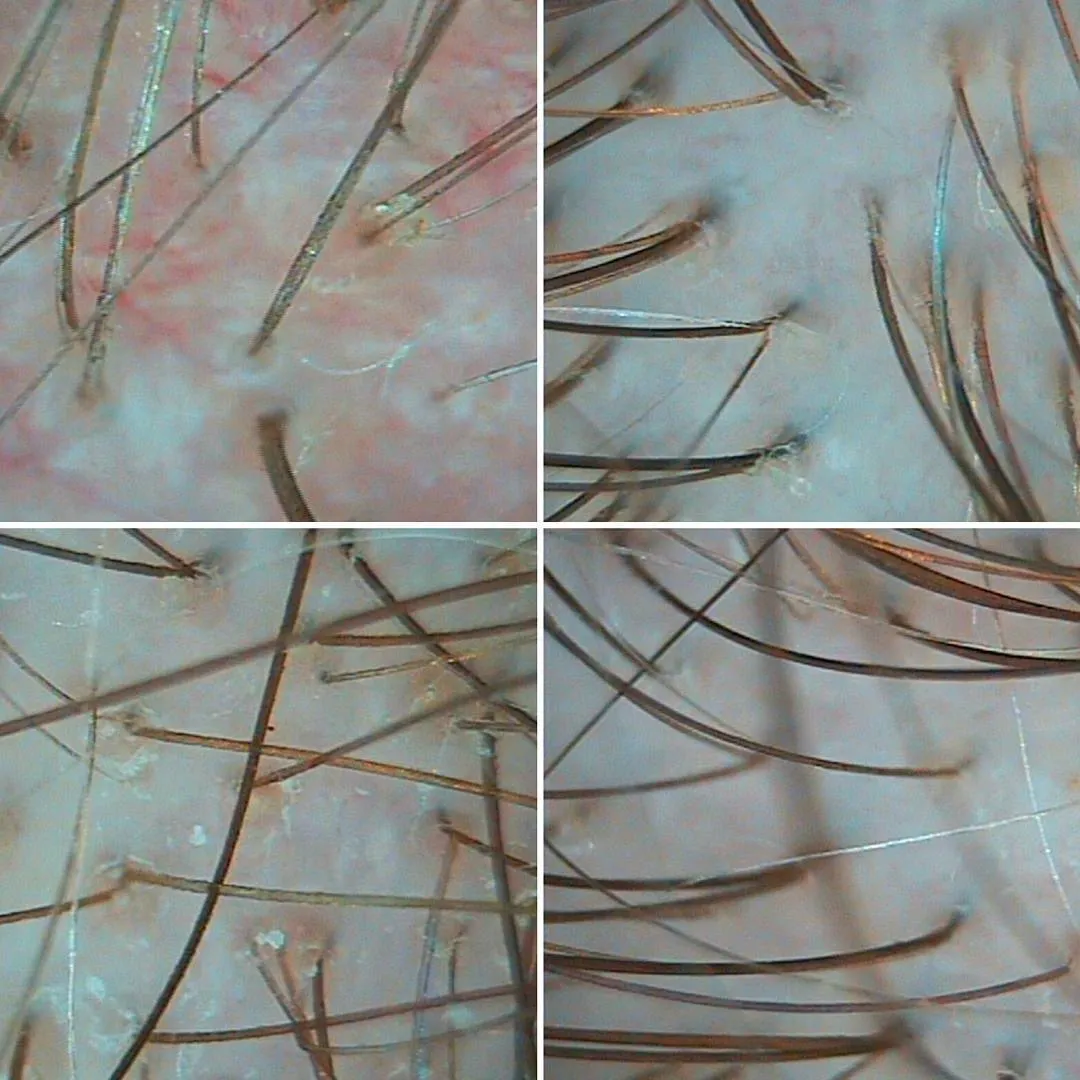 Актуальные новости: болезни волос