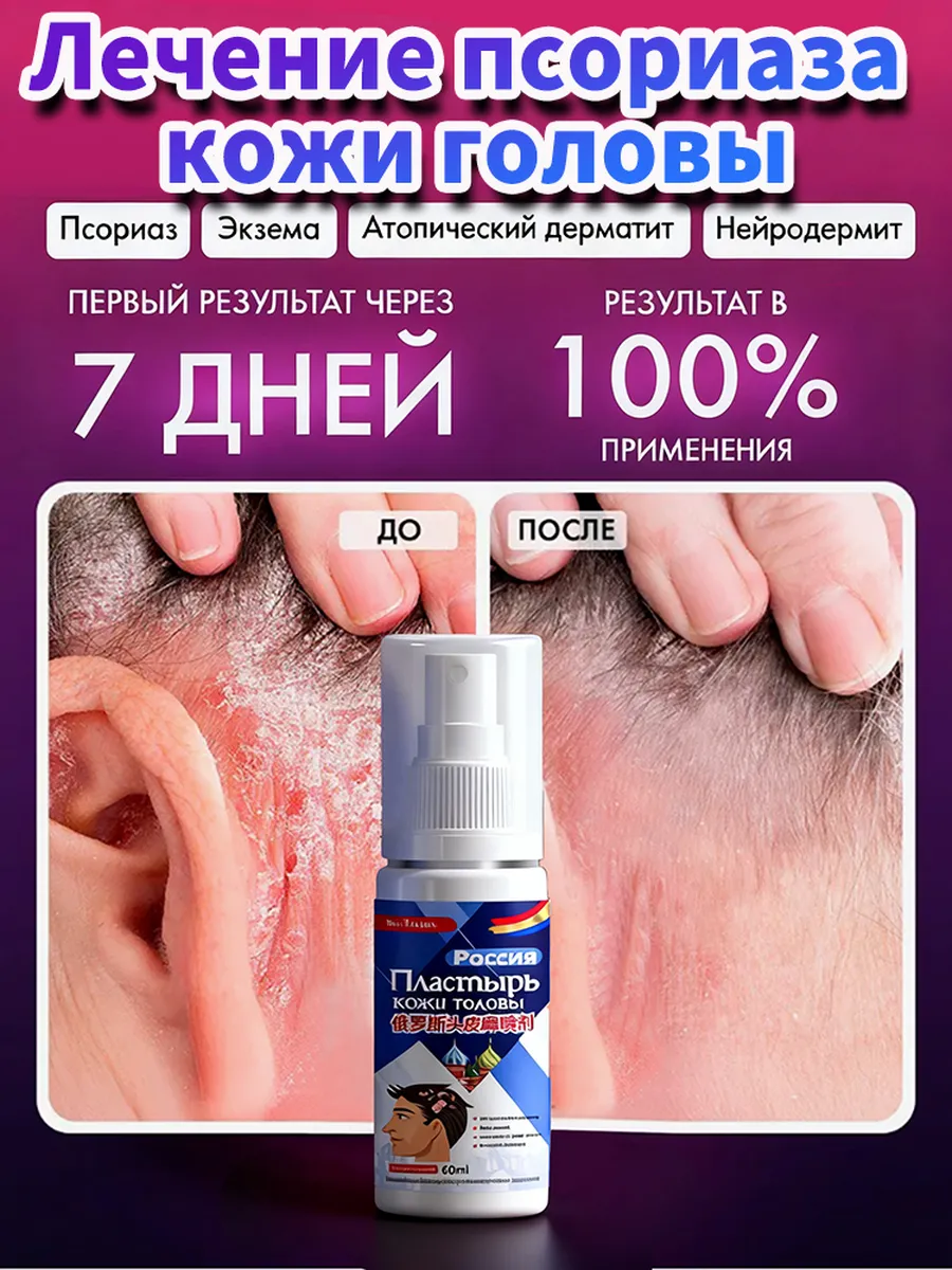 Визуальное объяснение: чем лечить зуд кожи головы