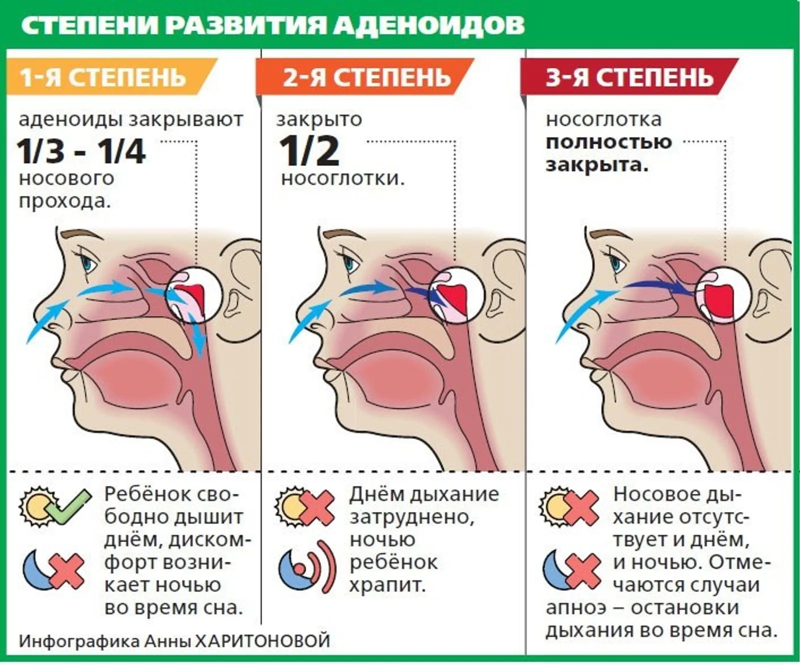 Современное оборудование для эффективного лечения без операции: врач проводит сеанс лазерной терапии на позвоночнике пациента