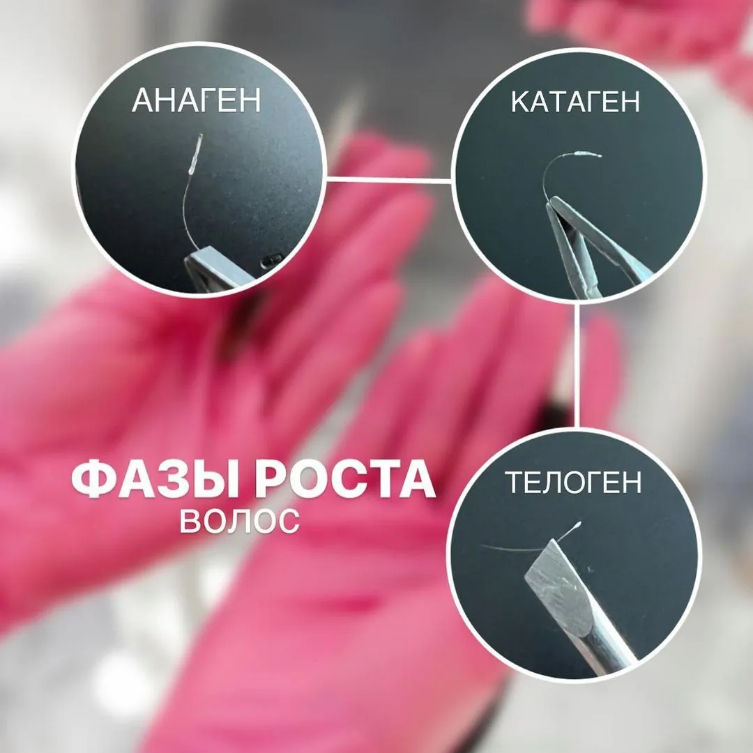 Визуальное объяснение: Фазы роста волос