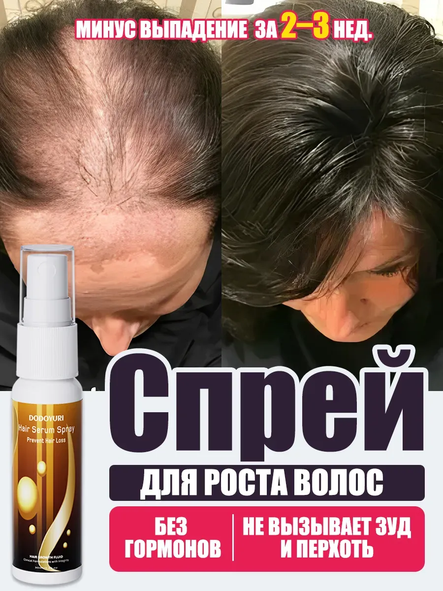 Образовательный материал - Как ускорить рост волос: проверенные методы и советы Визуальное объяснение: гормоны и рост волос