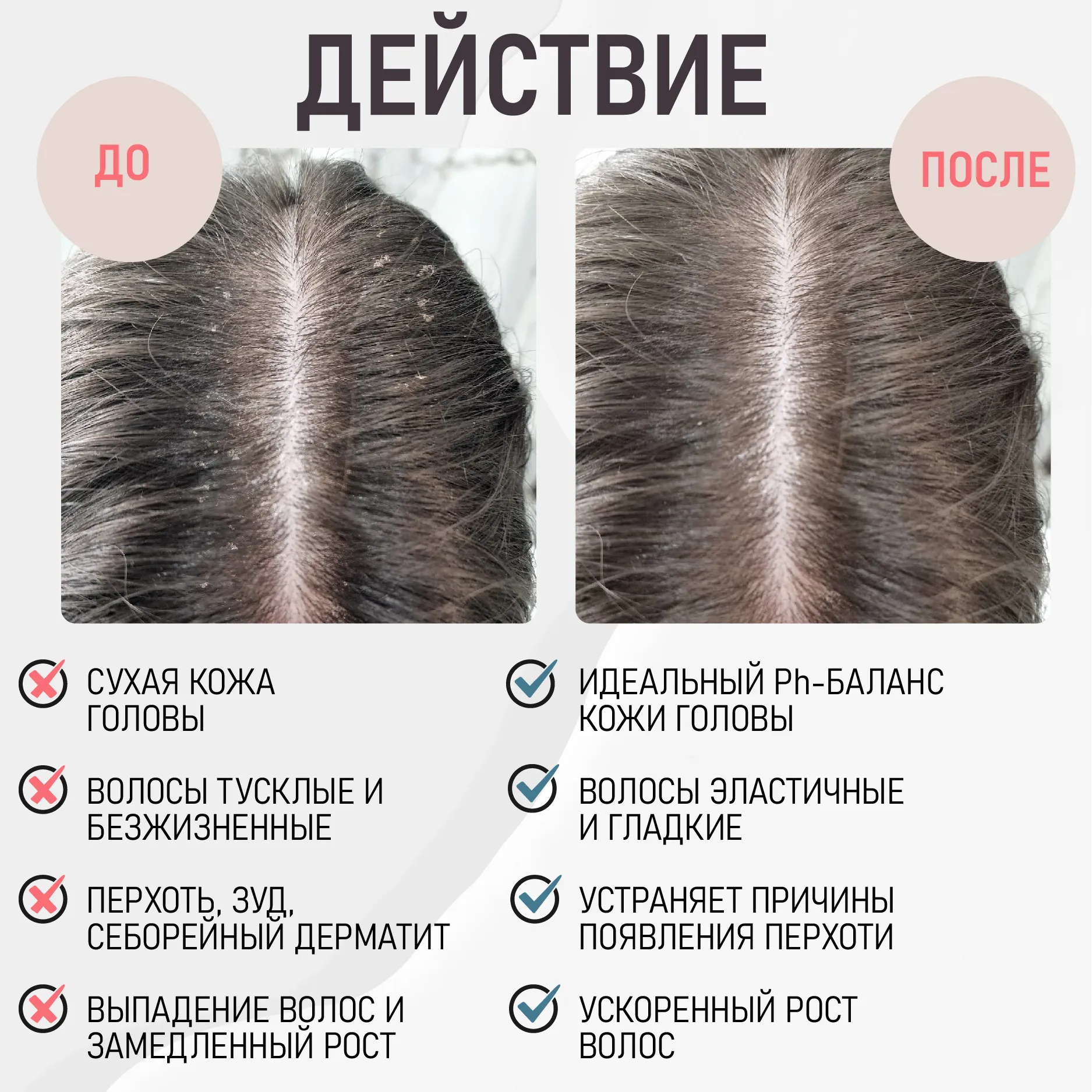 Визуальное руководство по: как быстро убрать перхоть